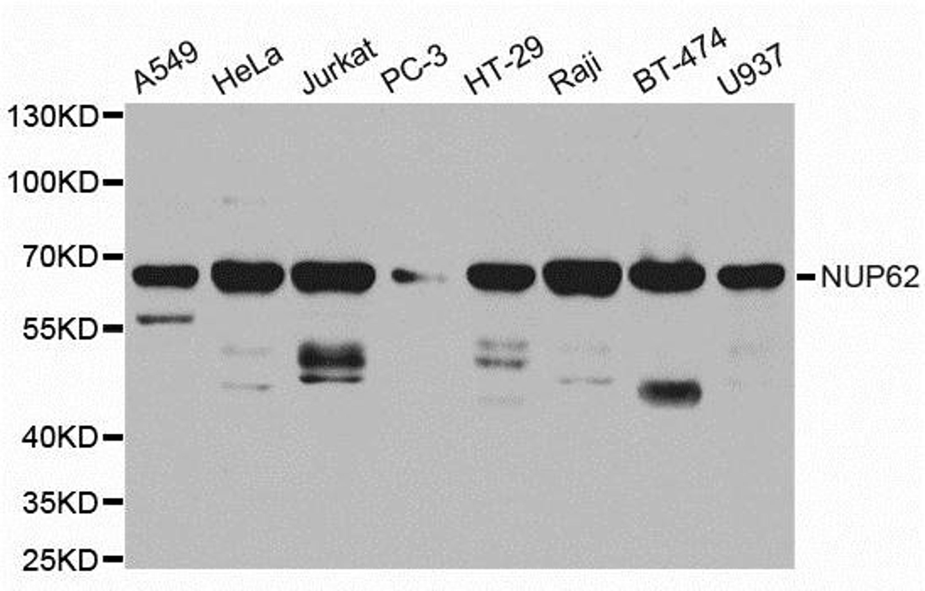 Western blot analysis of extracts of various cell lines using NUP62 antibody