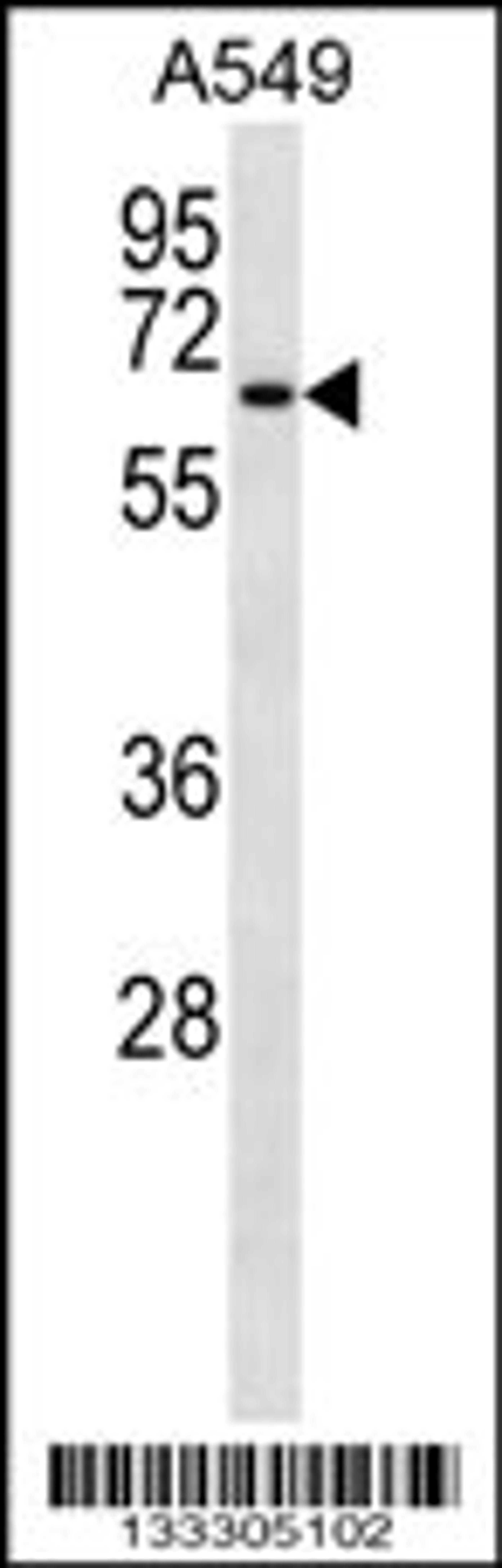 Western blot analysis in A549 cell line lysates (35ug/lane).