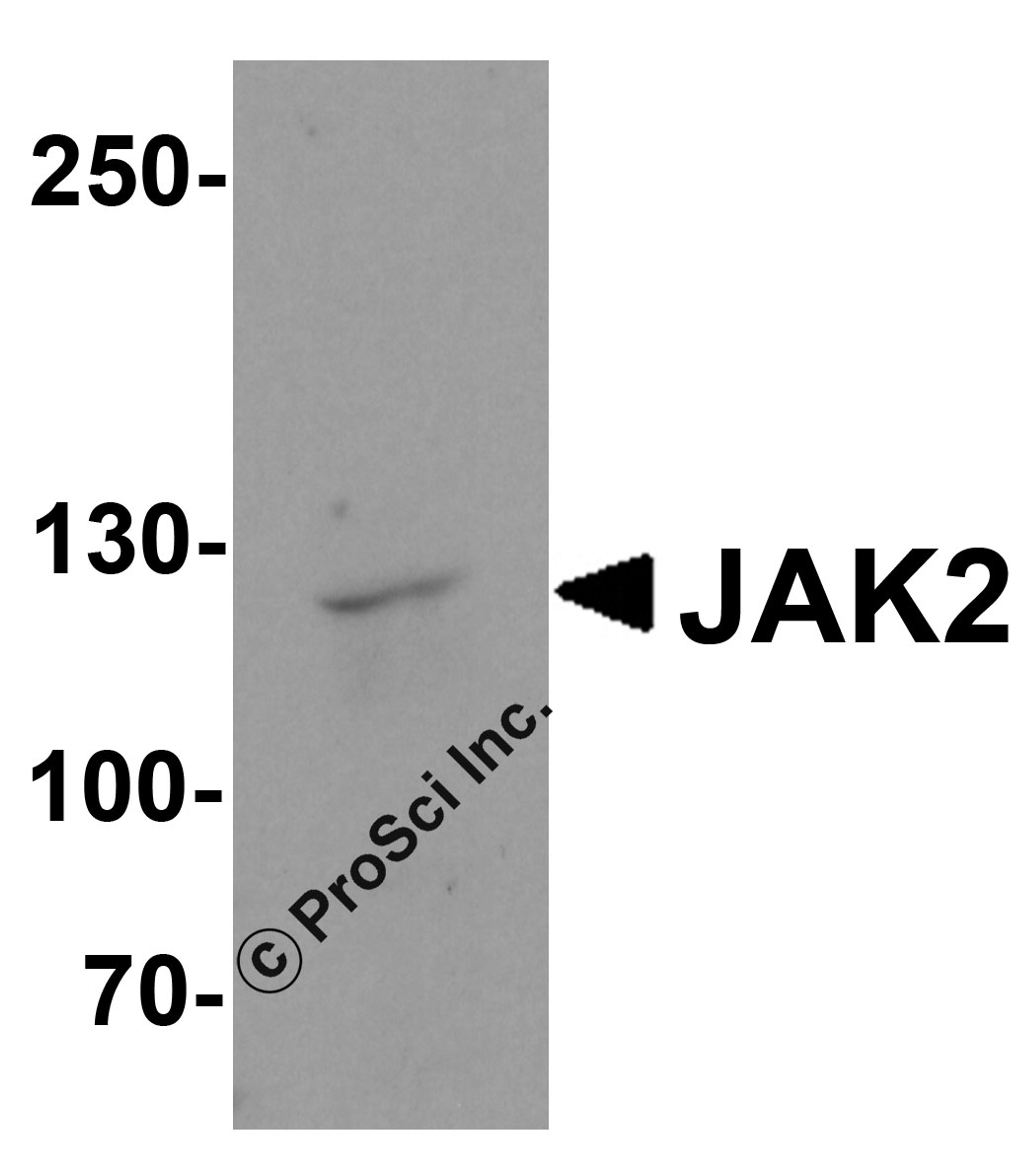 Western blot analysis of JAK2 in HeLa cell lysate with JAK2 antibody at 1 μg/ml.