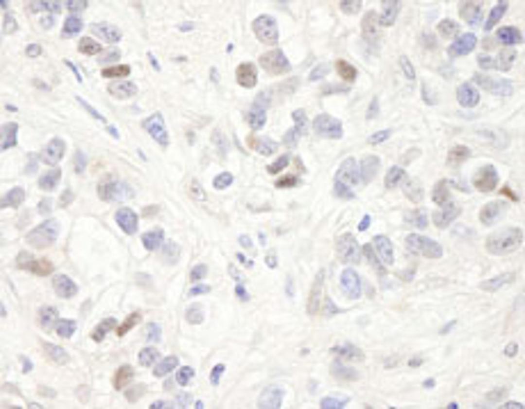 Detection of human MAGED2 by immunohistochemistry.