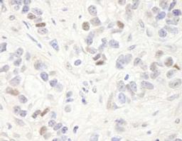 Detection of human MAGED2 by immunohistochemistry.