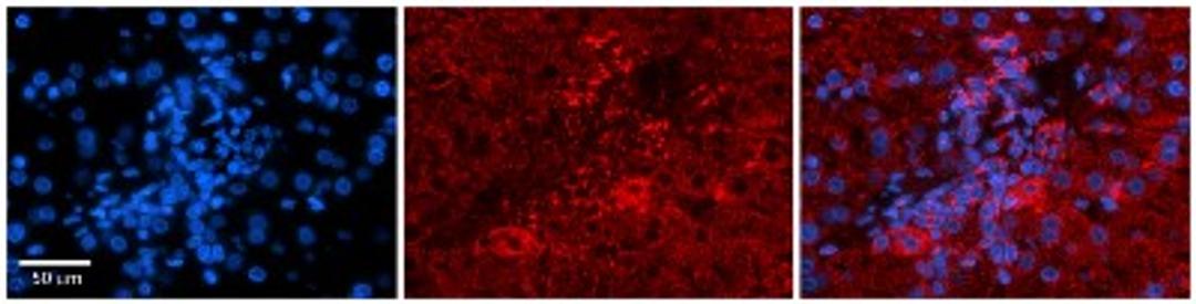 Immunohistochemistry: PDGF-B Antibody [NBP1-58279] - Human Adult liver Observed Staining: Cytoplasmic Primary Antibody Concentration: 1 : 600 Secondary Antibody: Donkey anti-Rabbit-Cy2/3 Secondary Antibody Concentration: 1 : 200 Magnification: 20X Exposure Time: 0.5 2.0 secProtocol located in Reviews and Data.