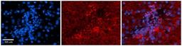 Immunohistochemistry: PDGF-B Antibody [NBP1-58279] - Human Adult liver Observed Staining: Cytoplasmic Primary Antibody Concentration: 1 : 600 Secondary Antibody: Donkey anti-Rabbit-Cy2/3 Secondary Antibody Concentration: 1 : 200 Magnification: 20X Exposure Time: 0.5 2.0 secProtocol located in Reviews and Data.