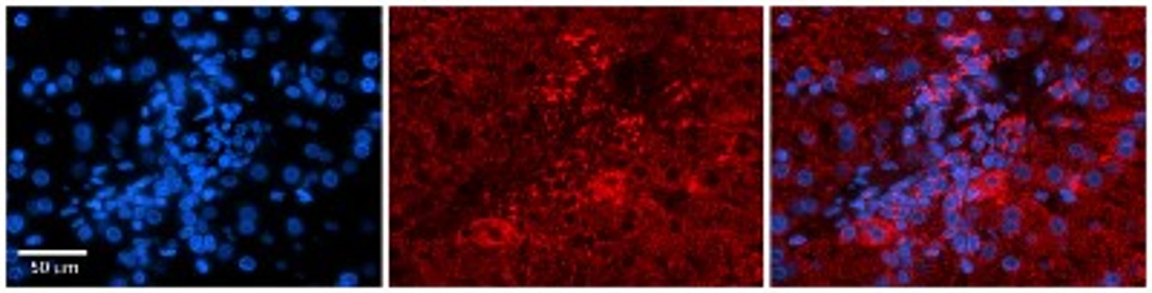 Immunohistochemistry: PDGF-B Antibody [NBP1-58279] - Human Adult liver Observed Staining: Cytoplasmic Primary Antibody Concentration: 1 : 600 Secondary Antibody: Donkey anti-Rabbit-Cy2/3 Secondary Antibody Concentration: 1 : 200 Magnification: 20X Exposure Time: 0.5 2.0 secProtocol located in Reviews and Data.