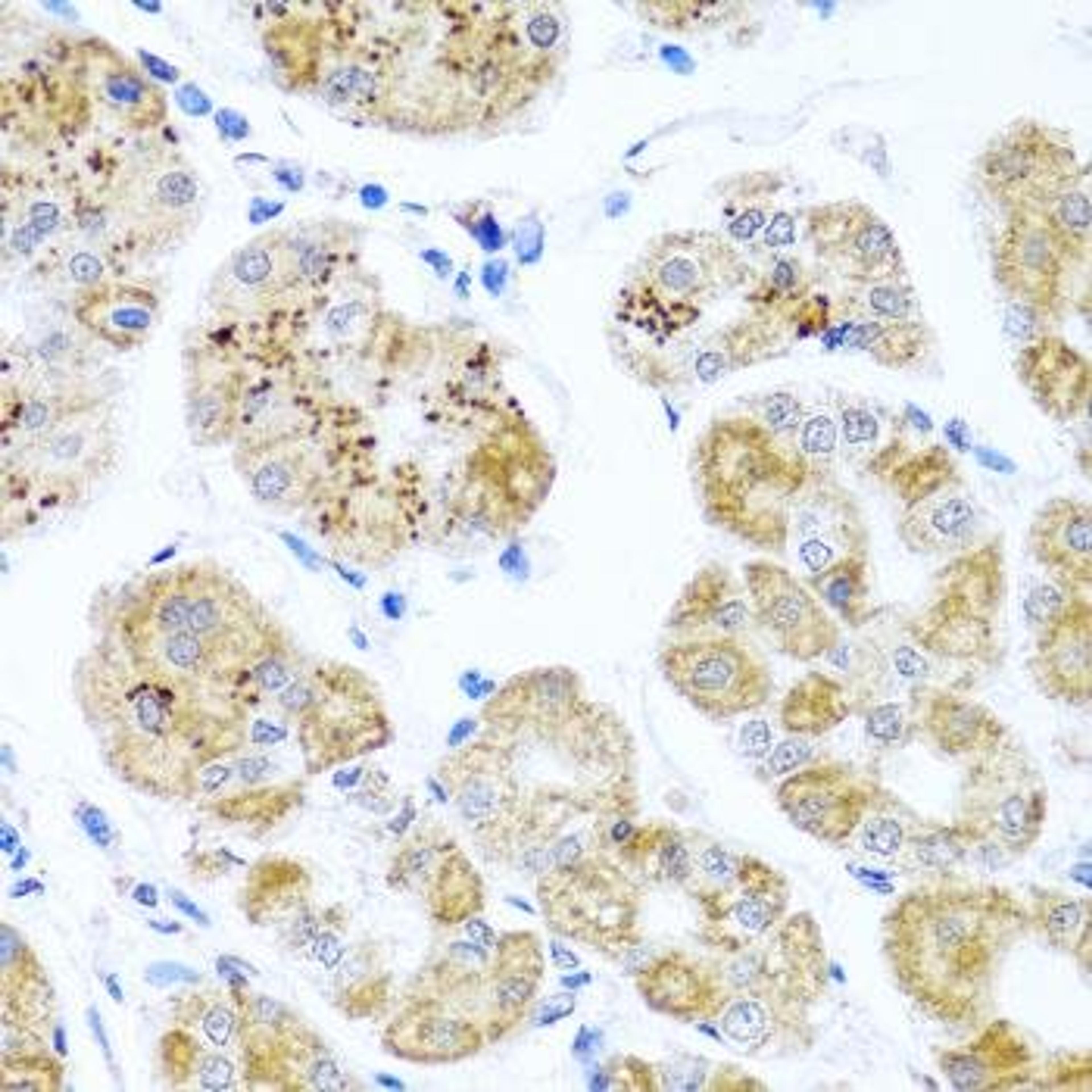 Immunohistochemical staining of human gastric tissue using PIP4K2B antibody (dilution of 1:100)