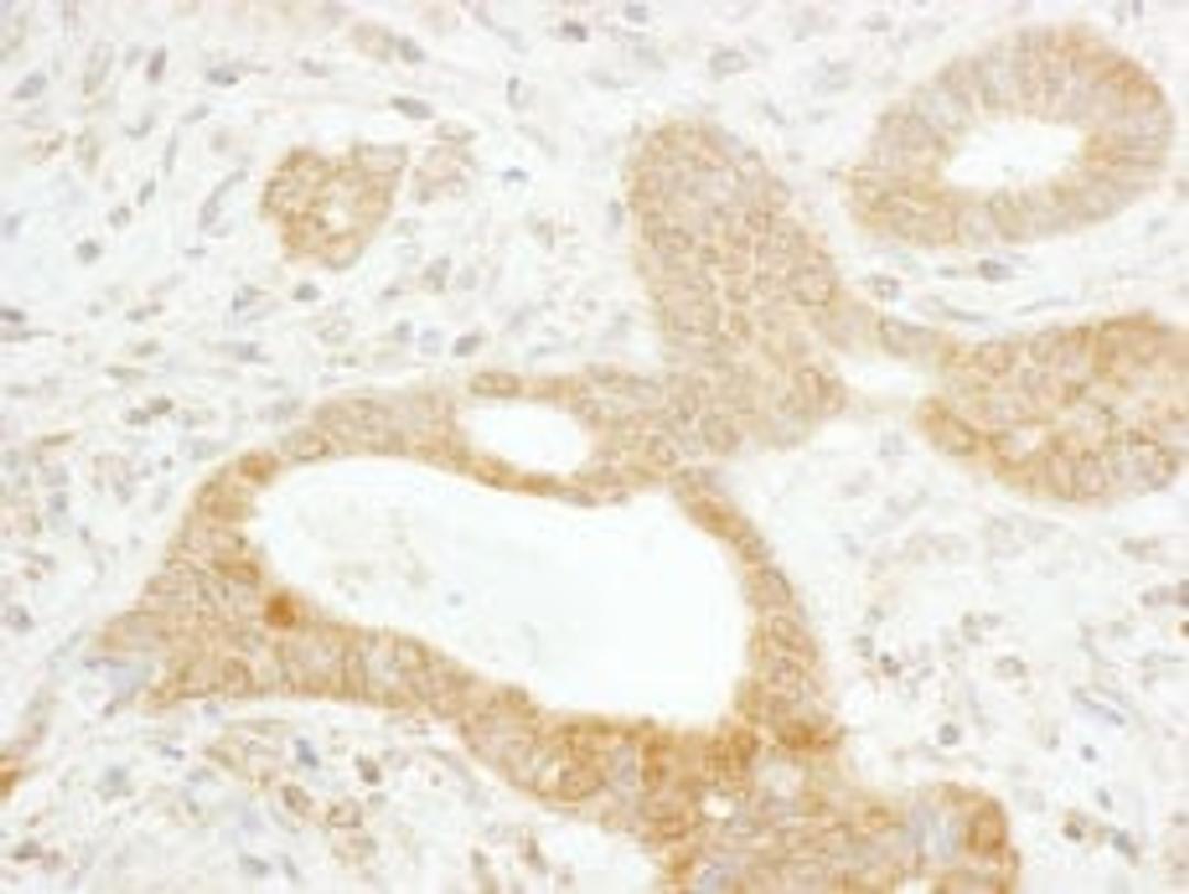 Detection of human Tankyrase 1 by immunohistochemistry.