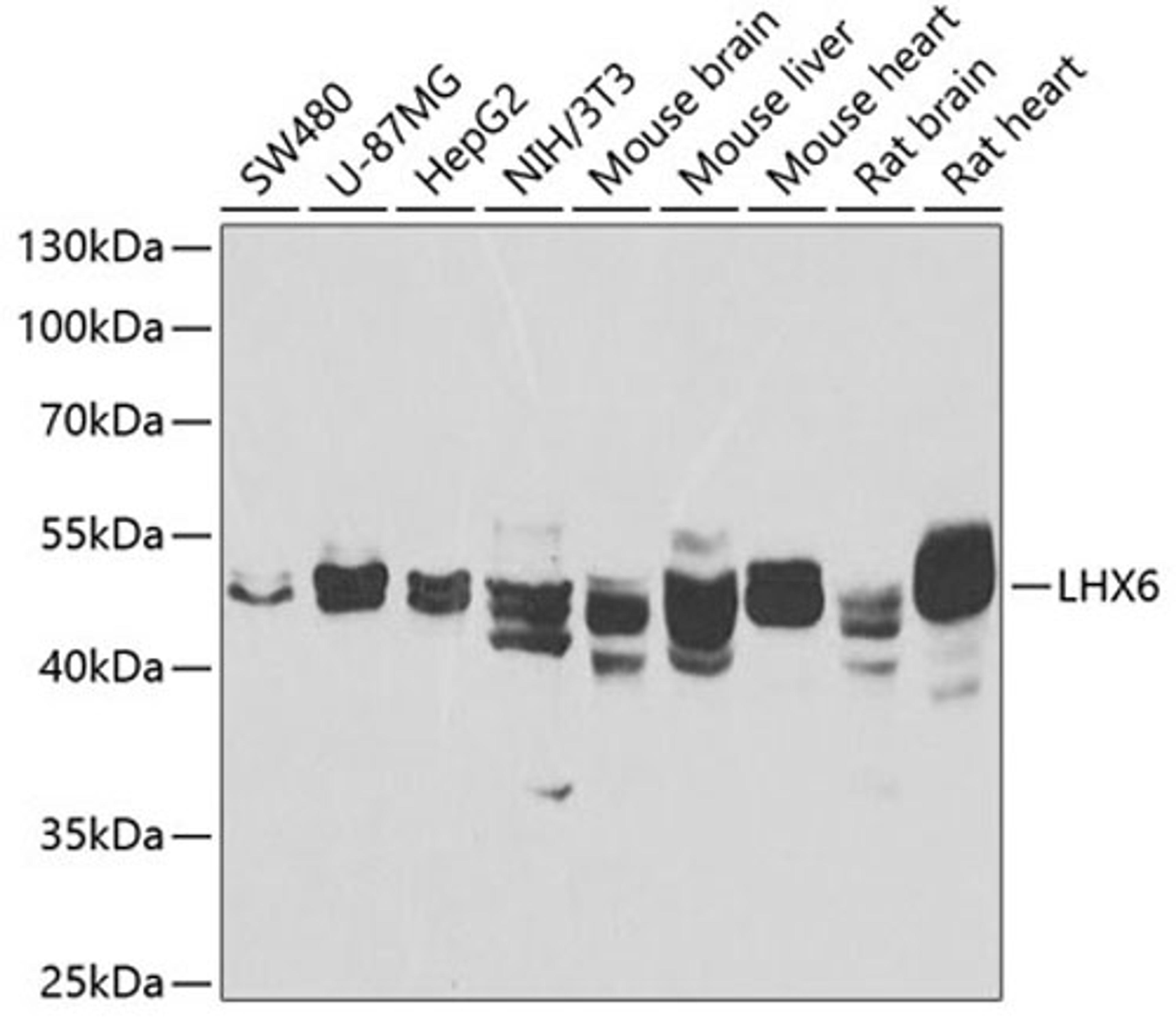 Western blot - LHX6 antibody (A7364)