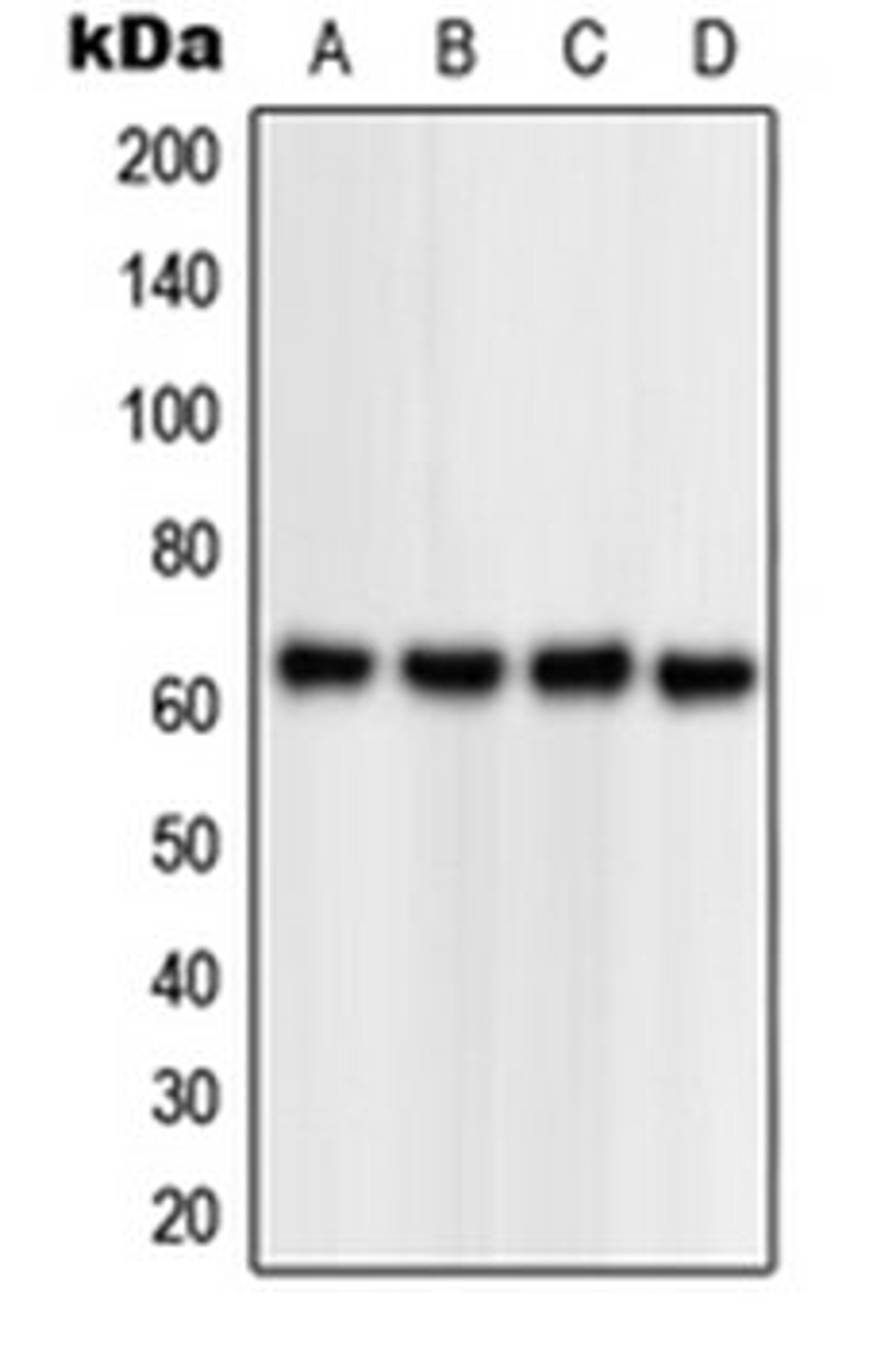 Western blot analysis of HEK293T (Lane 1), Jurkat (Lane 2), Raw264.7 (Lane 3), rat kidney (Lane 4) whole cell lysates using NPAS1 antibody