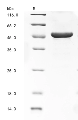 (Tris-Glycine gel) Discontinuous SDS-PAGE (reduced) with 5% enrichment gel and 15% separation gel.