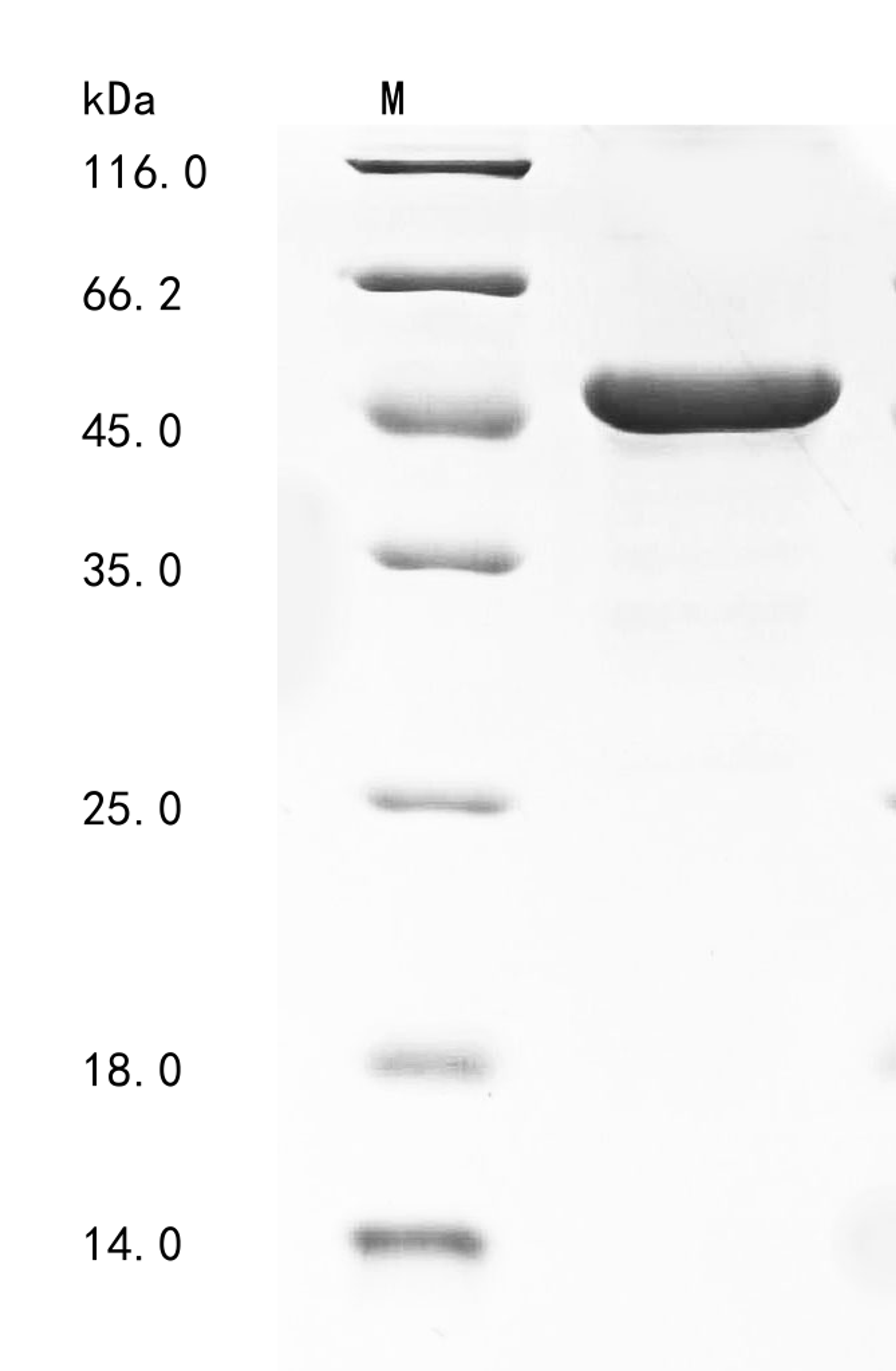 (Tris-Glycine gel) Discontinuous SDS-PAGE (reduced) with 5% enrichment gel and 15% separation gel.