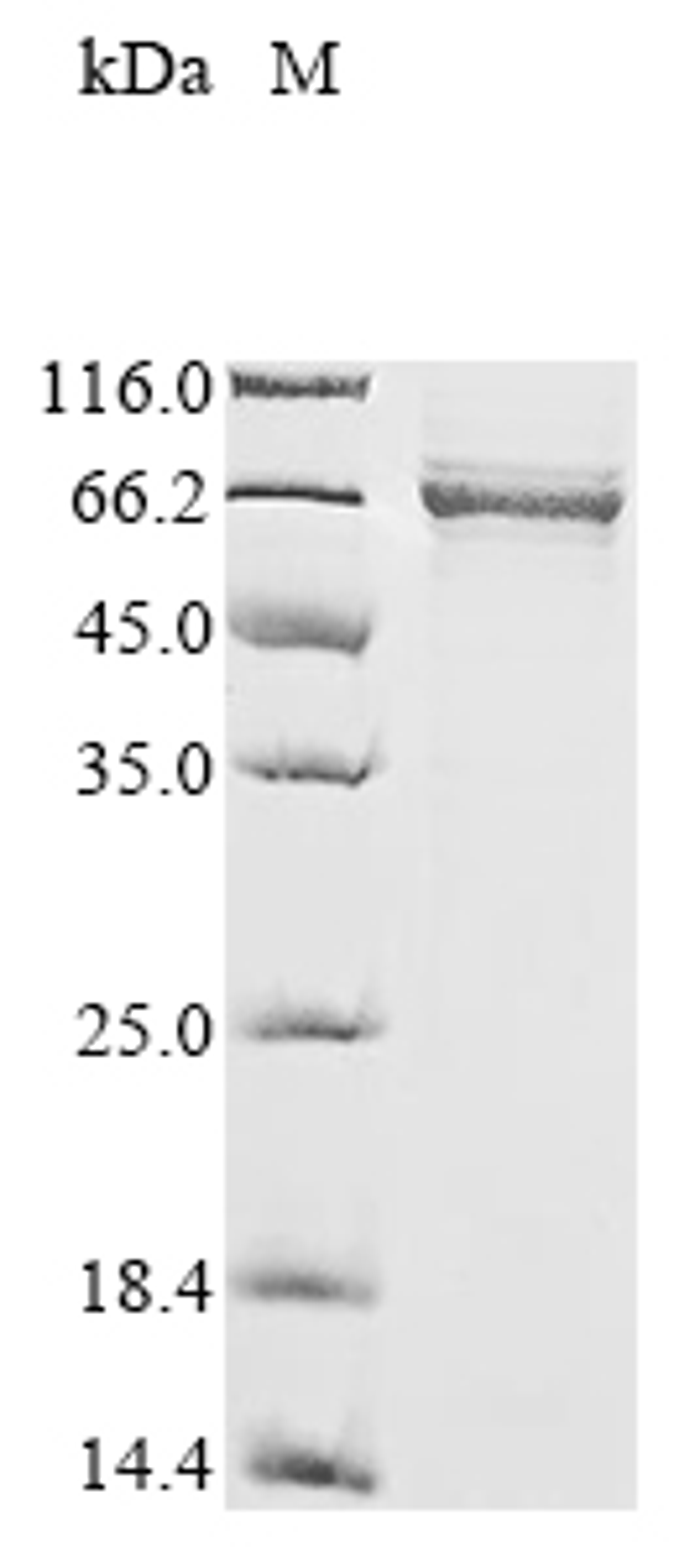 (Tris-Glycine gel) Discontinuous SDS-PAGE (reduced) with 5% enrichment gel and 15% separation gel.