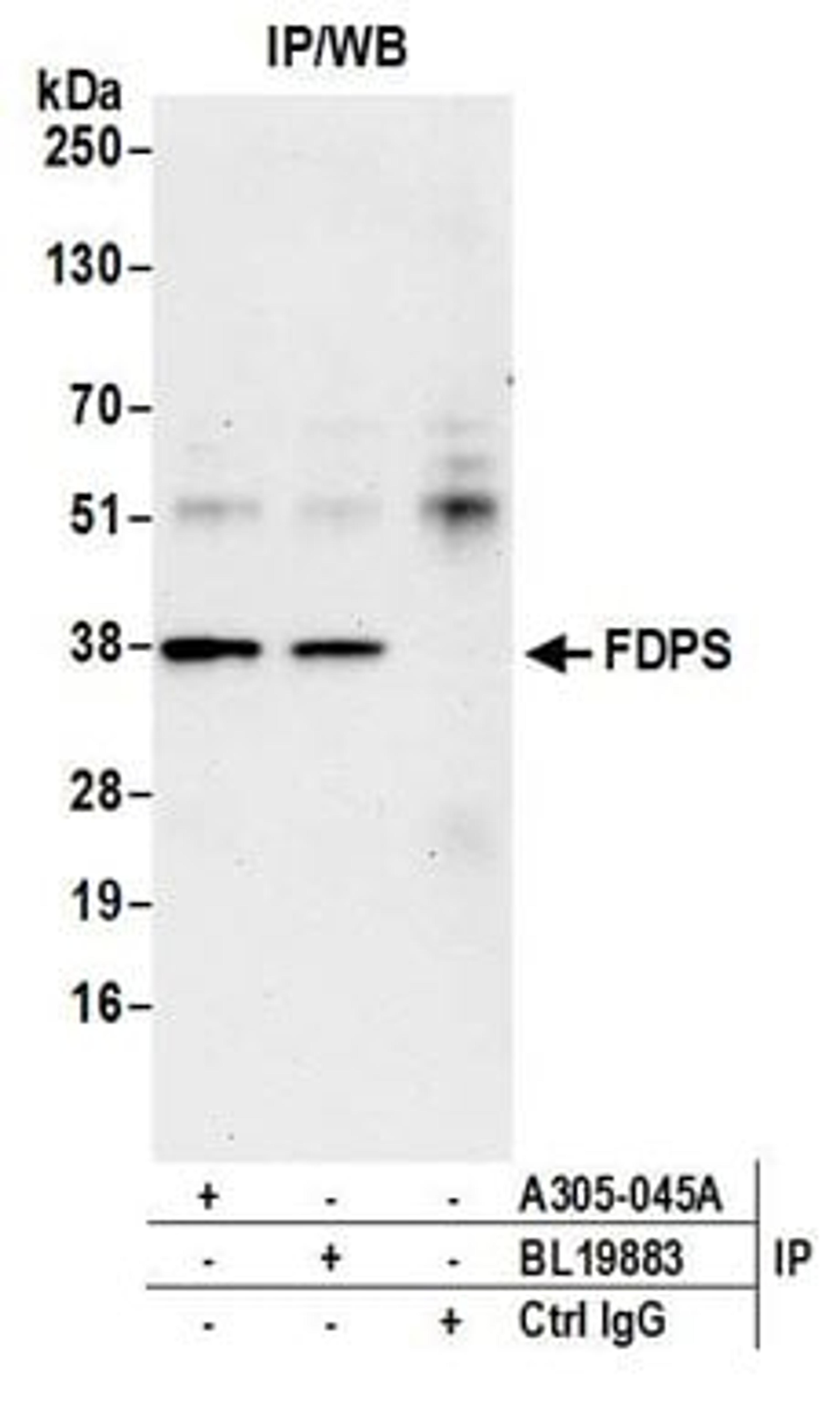 Detection of human FDPS by western blot of immunoprecipitates.