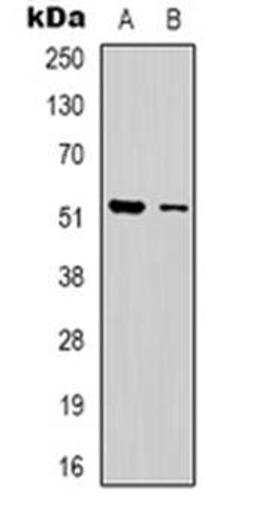 Western blot analysis of Dematin expression in Jurkat (Lane 1), HEK293T (Lane 2) whole cell lysates using DMTN antibody