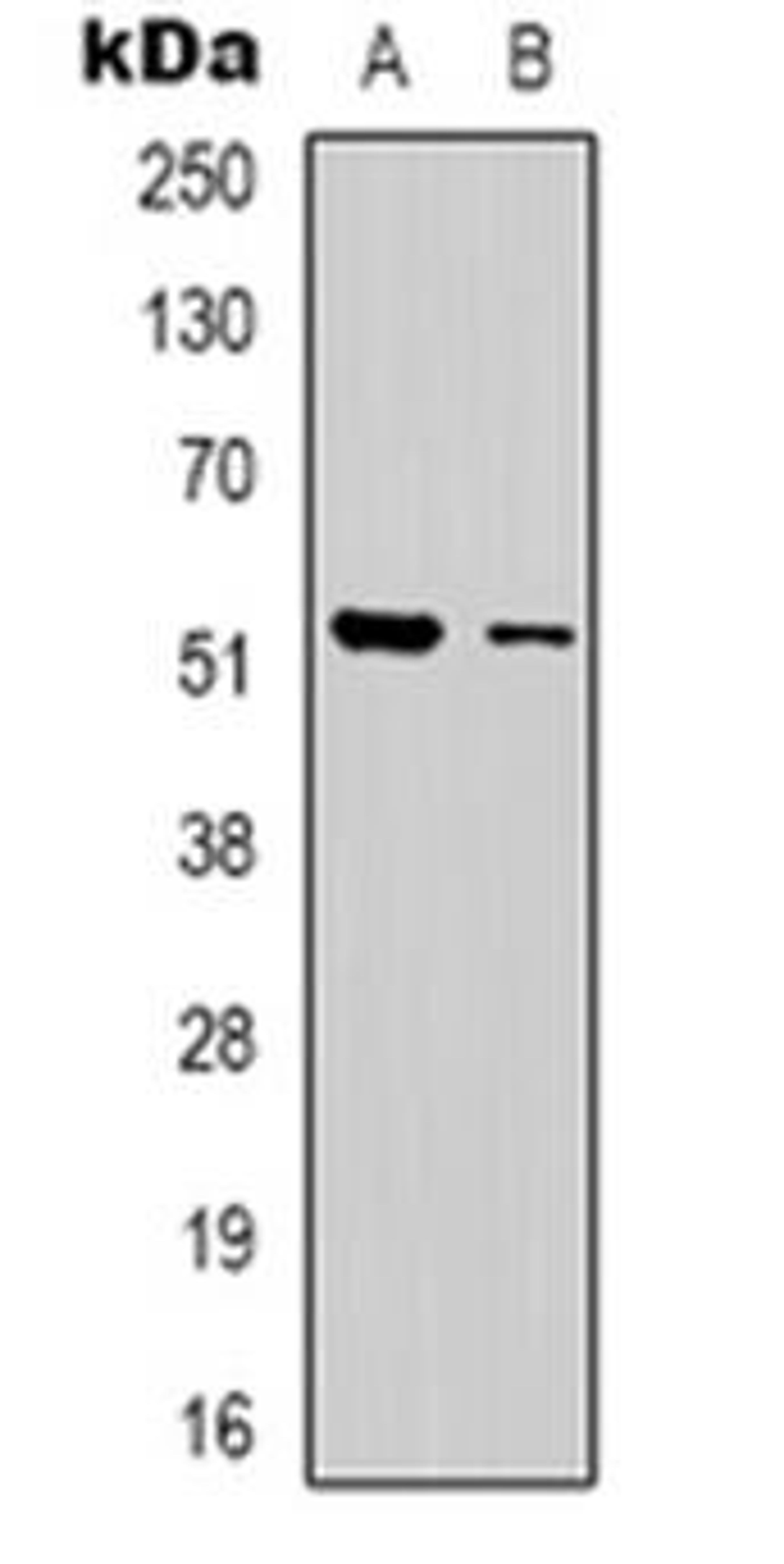 Western blot analysis of Dematin expression in Jurkat (Lane 1), HEK293T (Lane 2) whole cell lysates using DMTN antibody