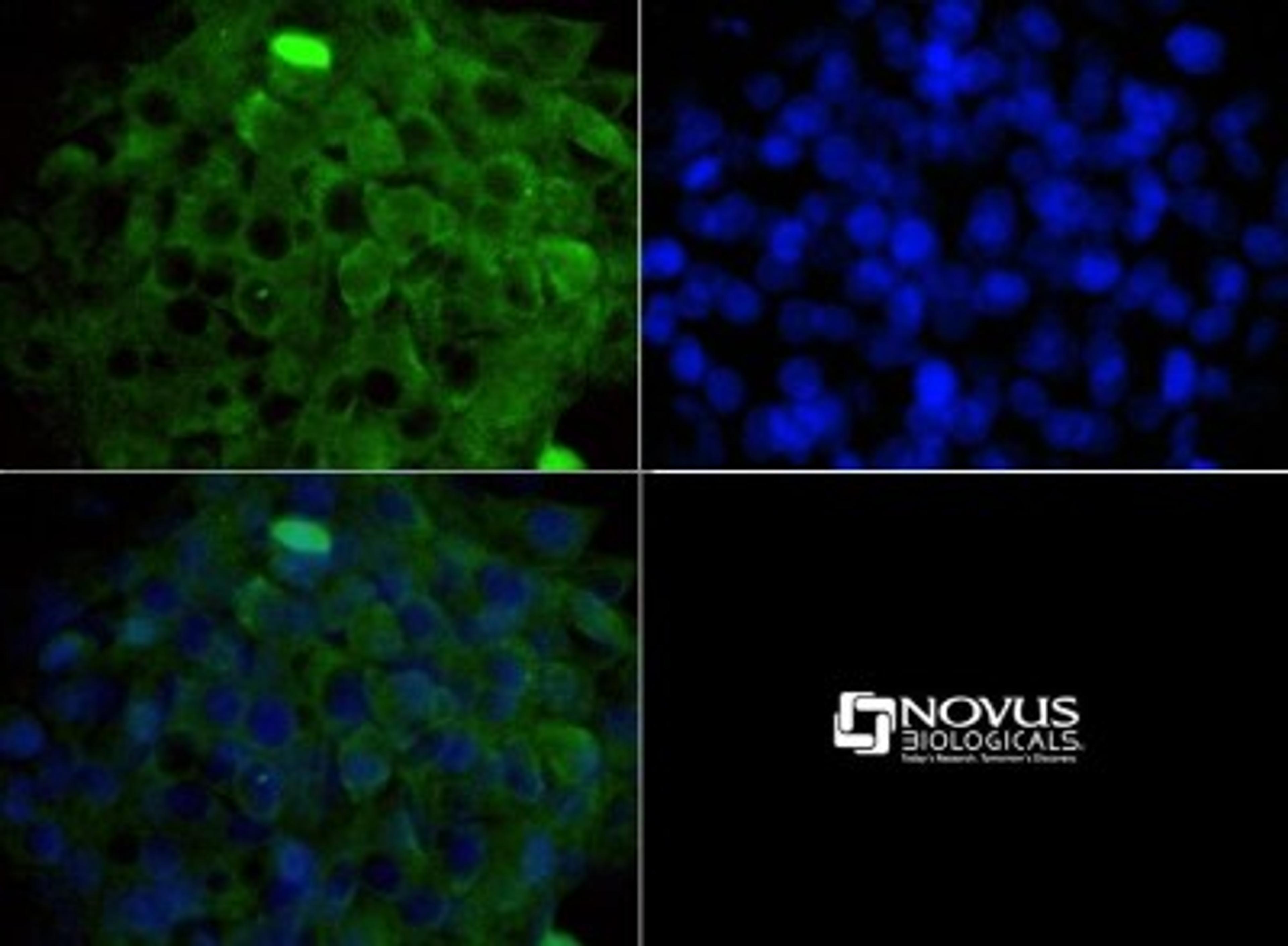 Immunocytochemistry/Immunofluorescence: MP1/MAP2K1IP1 Antibody [NBP1-50631] - ICC staining of MAP2K1IP1 in HepG2 cells with FITC (green). Nuclei were counterstained with DAPI (blue).