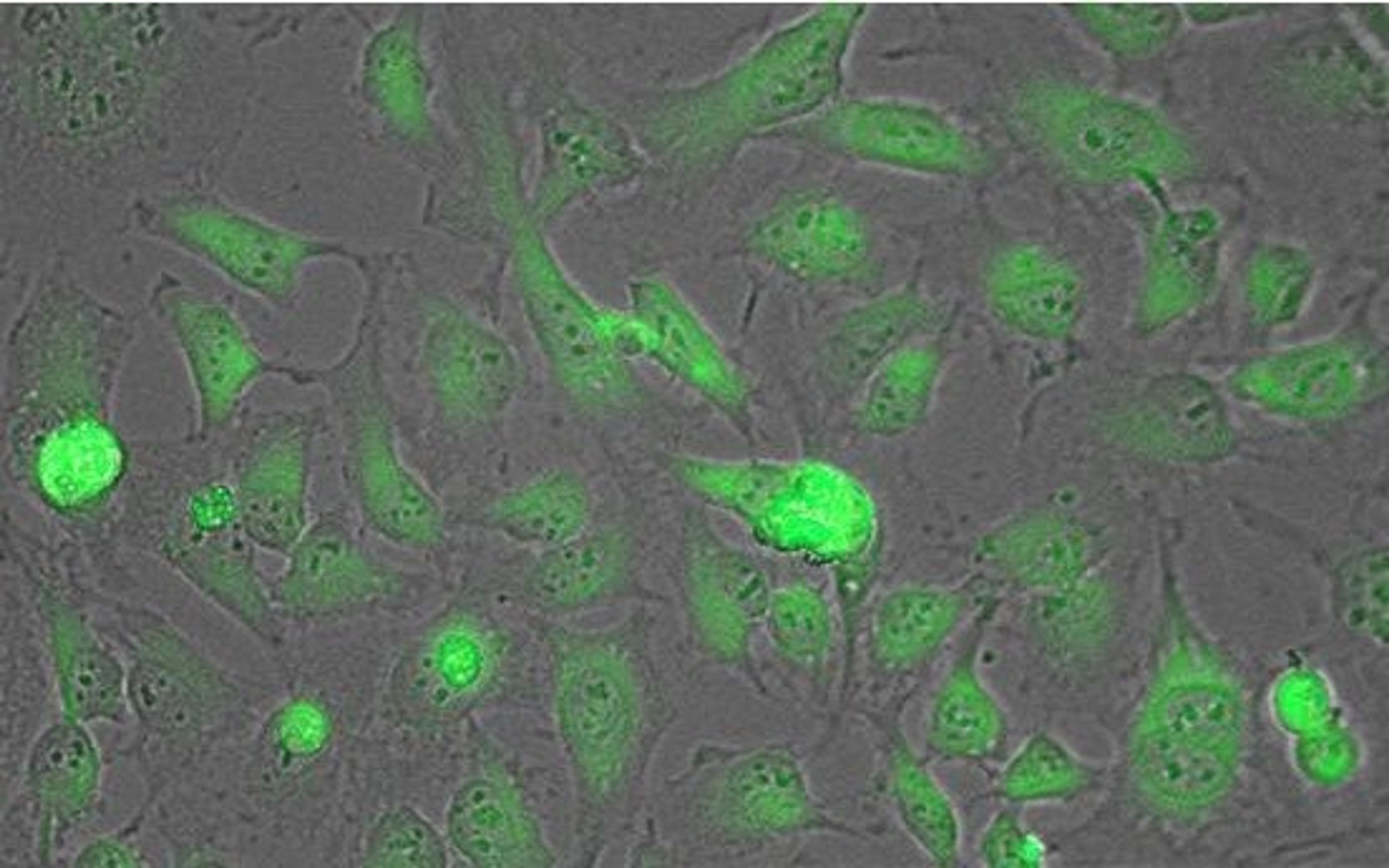 Immunofluorescence analysis of HeLa cells using Lactate Dehydrogenase antibody (Peroxidase)