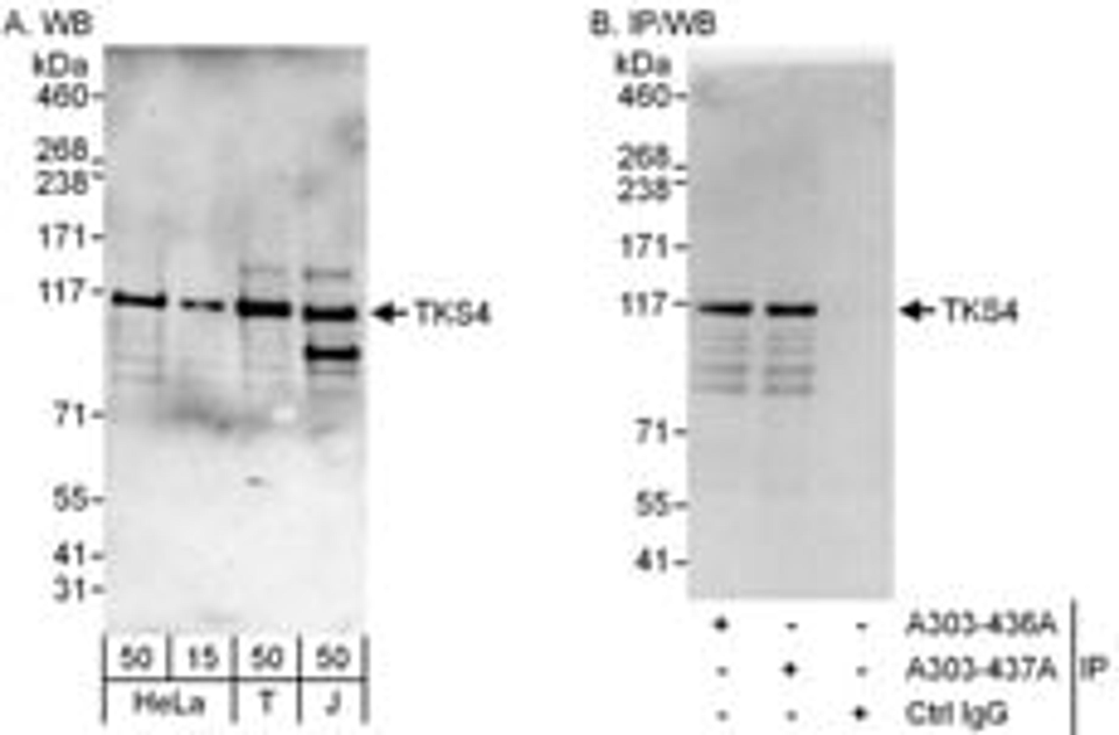 Detection of human TKS4 by western blot and immunoprecipitation.