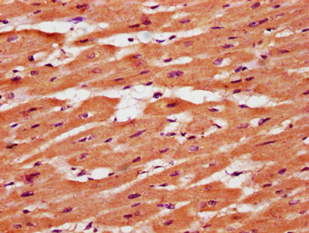 IHC image of CSB-PA023694LA01HU diluted at 1:400 and staining in paraffin-embedded human heart tissue performed on a Leica BondTM system. After dewaxing and hydration, antigen retrieval was mediated by high pressure in a citrate buffer (pH 6.0). Section was blocked with 10% normal goat serum 30min at RT. Then primary antibody (1% BSA) was incubated at 4&deg;C overnight. The primary is detected by a biotinylated secondary antibody and visualized using an HRP conjugated SP system.