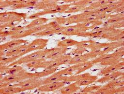 IHC image of CSB-PA023694LA01HU diluted at 1:400 and staining in paraffin-embedded human heart tissue performed on a Leica BondTM system. After dewaxing and hydration, antigen retrieval was mediated by high pressure in a citrate buffer (pH 6.0). Section was blocked with 10% normal goat serum 30min at RT. Then primary antibody (1% BSA) was incubated at 4&deg;C overnight. The primary is detected by a biotinylated secondary antibody and visualized using an HRP conjugated SP system.