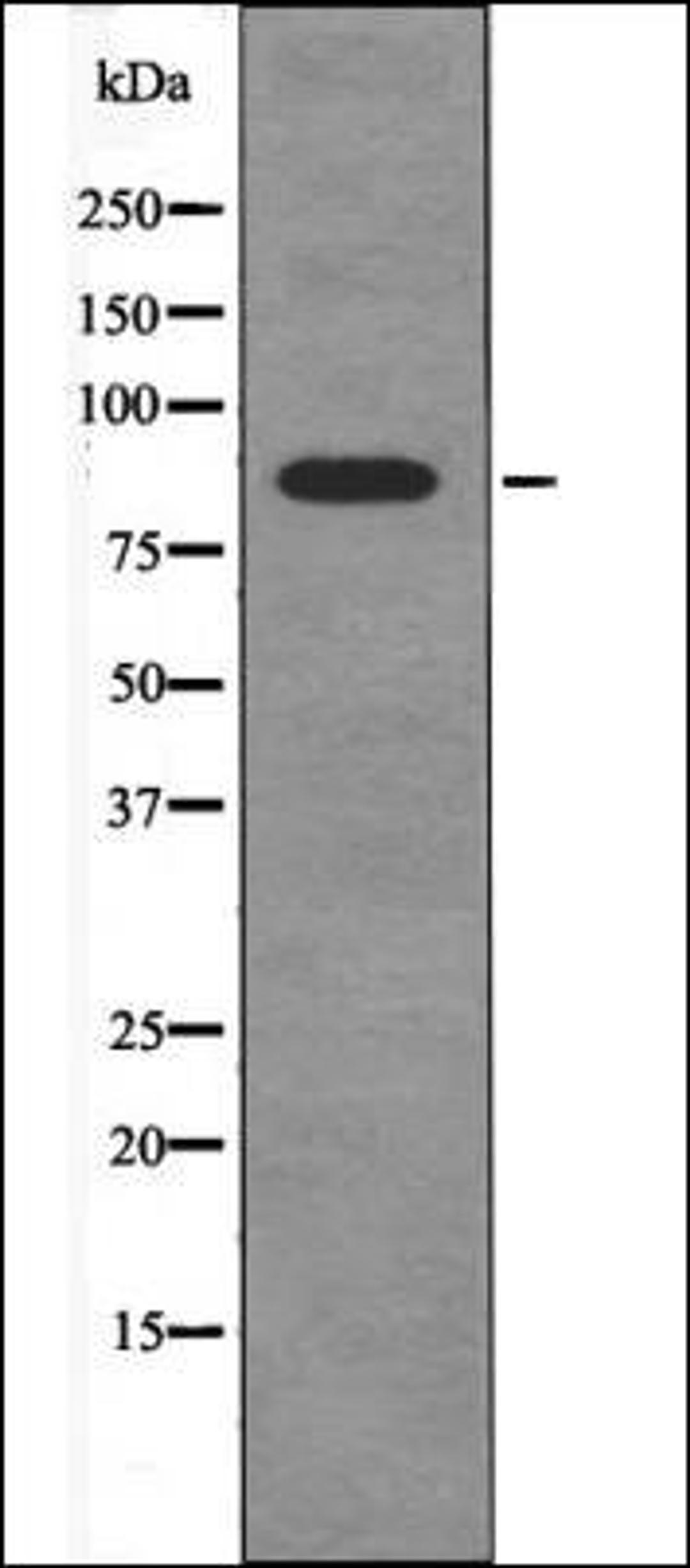 Western blot analysis of NIH-3T3 whole cell lysates using FGFR4 -Phospho-Tyr754- antibody