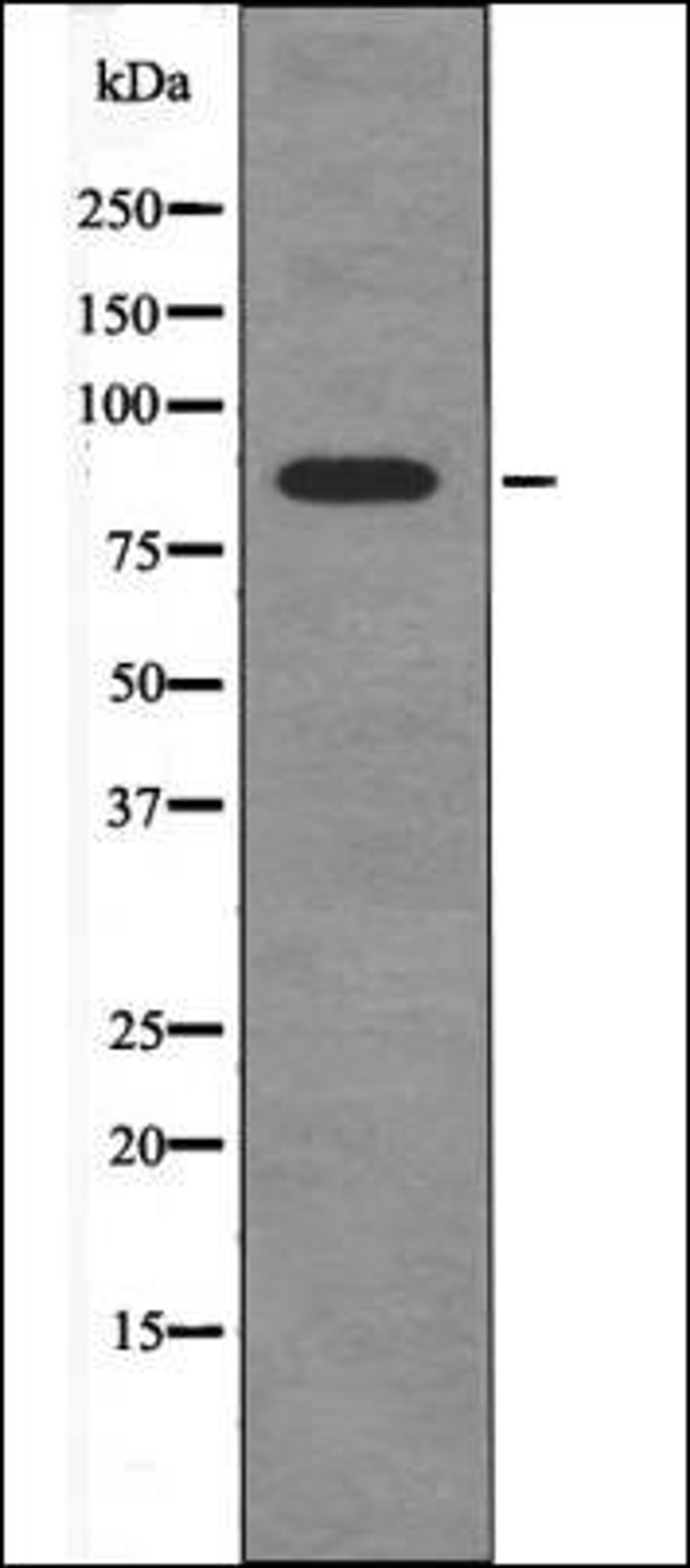 Western blot analysis of NIH-3T3 whole cell lysates using FGFR4 -Phospho-Tyr754- antibody