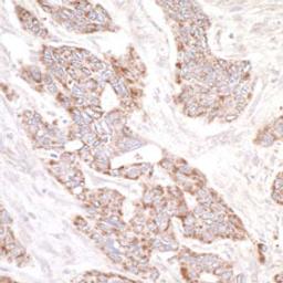 Detection of human PDZ-GEF1 by immunohistochemistry.