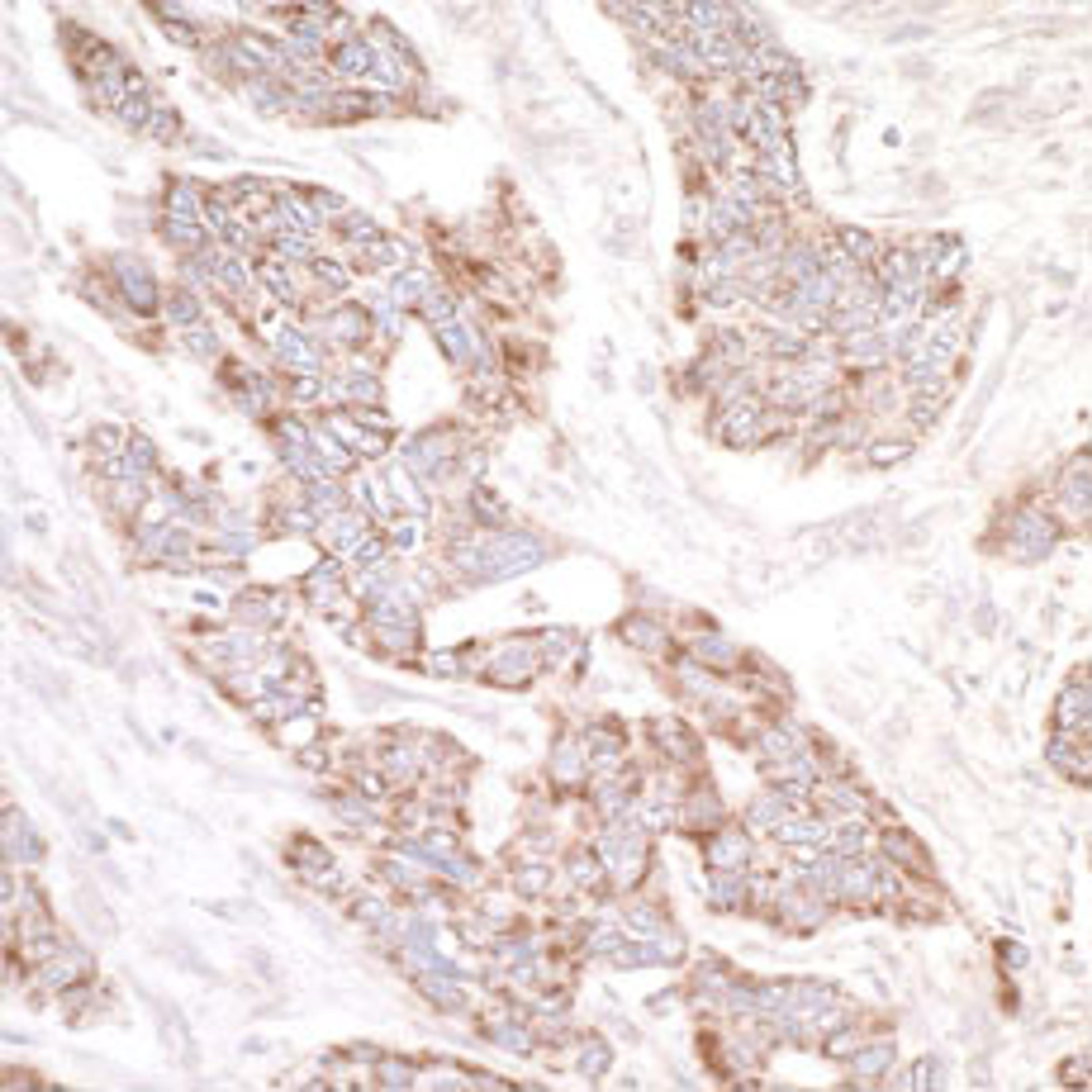 Detection of human PDZ-GEF1 by immunohistochemistry.