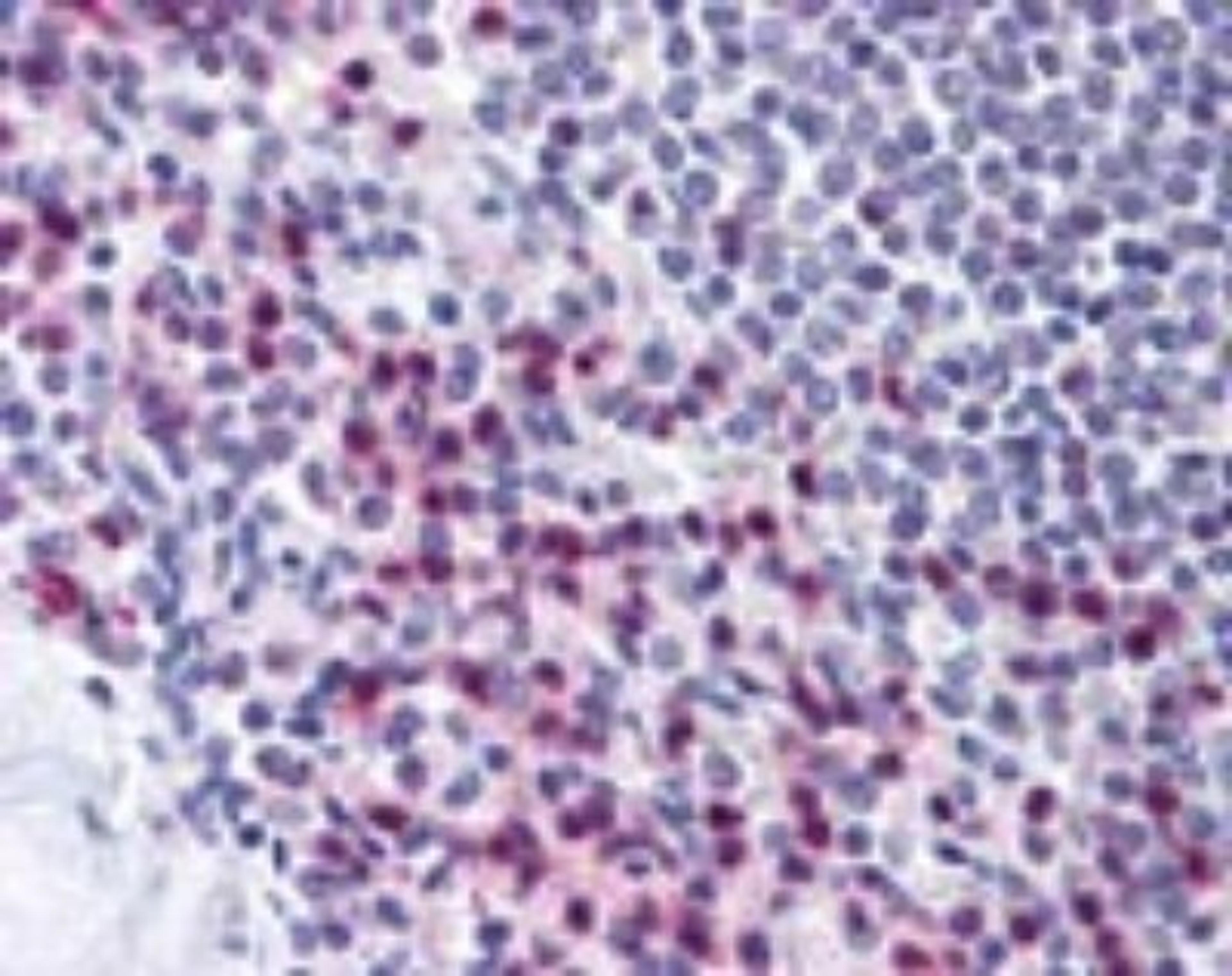 Immunohistochemistry-Paraffin: STRAP Antibody [NBP2-24740] - IHC analysis of human spleen using NBP2-24740 at 10 ug/ml.