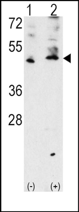 Western blot analysis of VEGF3 Antibody polyclonal antibody using 293 cell lysates (2 ug/lane) either nontransfected (Lane 1) or transiently transfected with the VEGF3 gene (Lane 2).