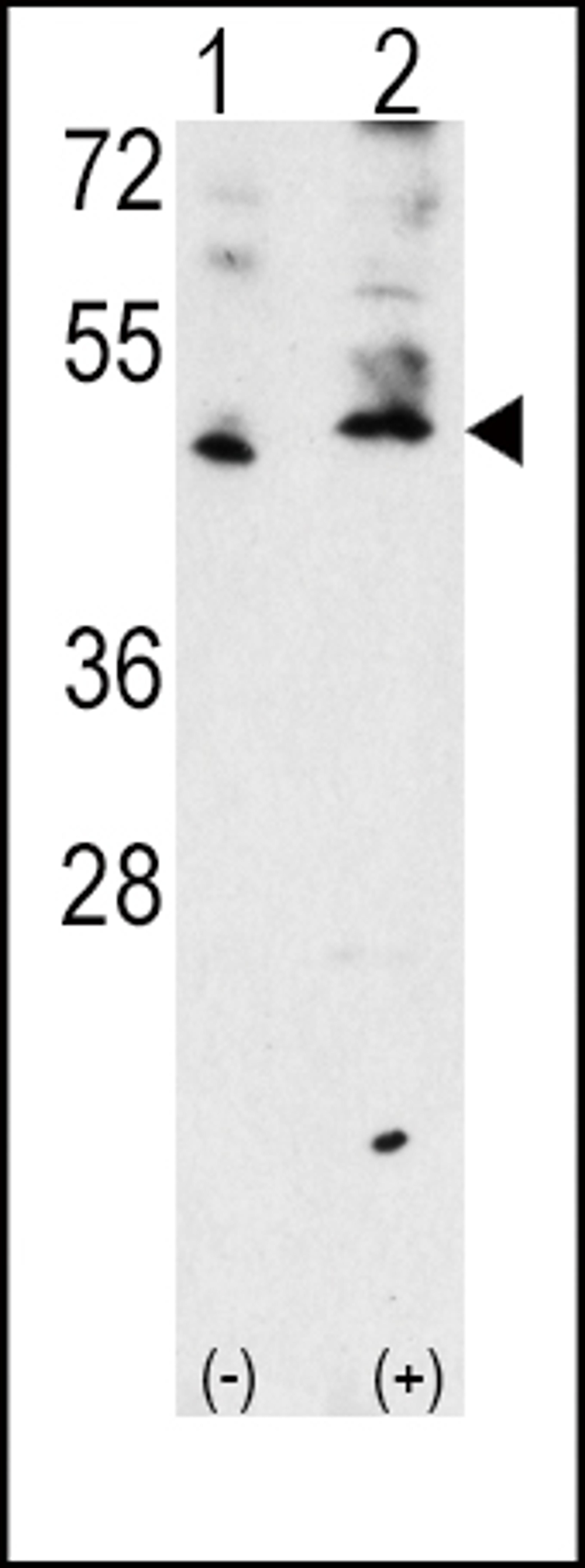 Western blot analysis of VEGF3 Antibody polyclonal antibody using 293 cell lysates (2 ug/lane) either nontransfected (Lane 1) or transiently transfected with the VEGF3 gene (Lane 2).