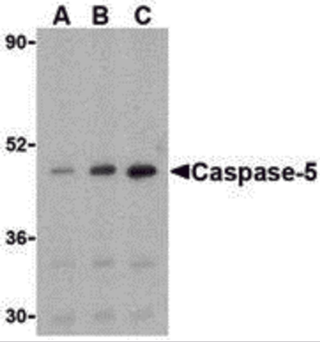 Western blot analysis of caspase-5 in Ramos cells with caspase-5 antibody at (A) 0.5, (B) 1, and (C) 2 μg/mL.