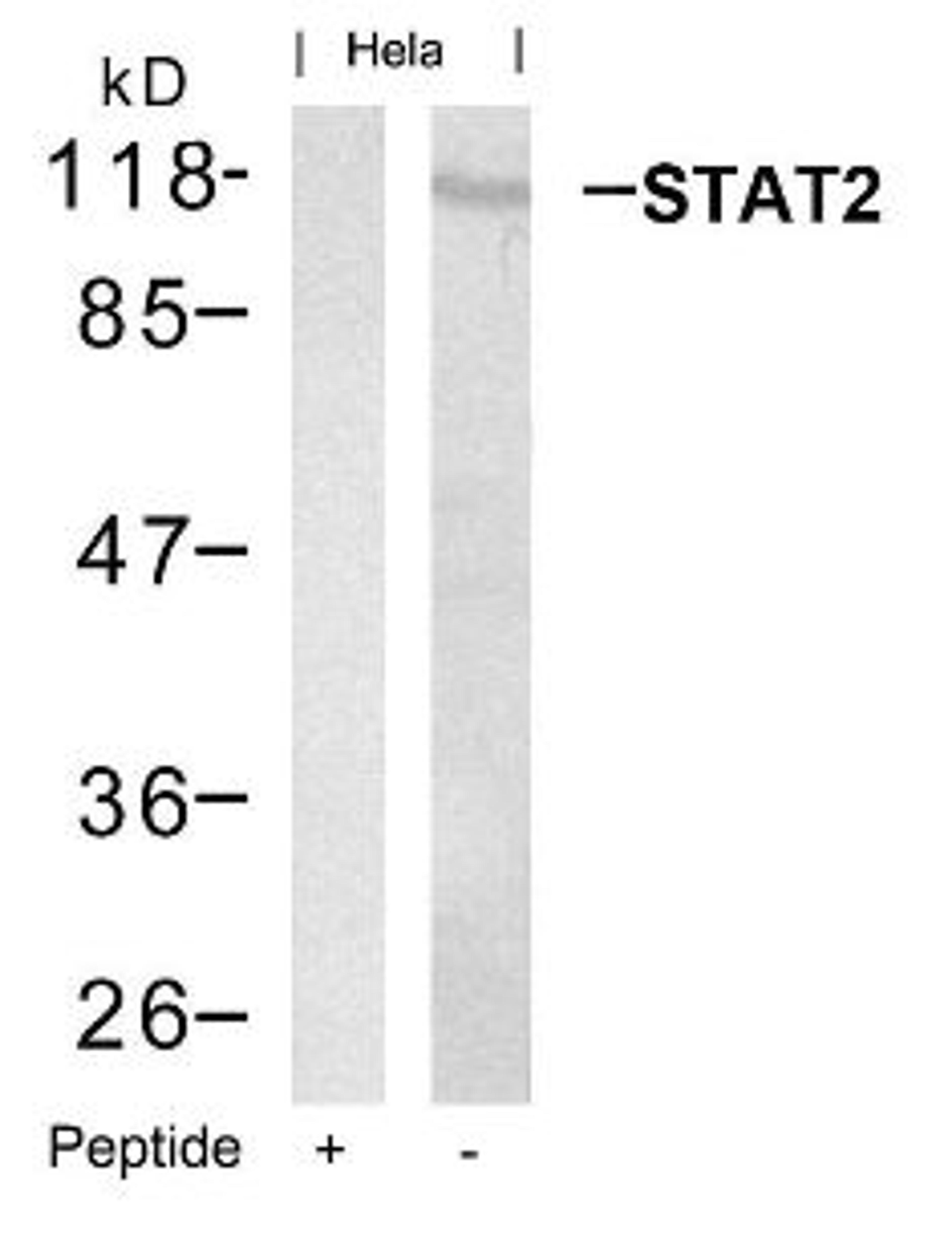 Western blot analysis of lysed extracts from HeLa cells using STAT2 (Ab-690).