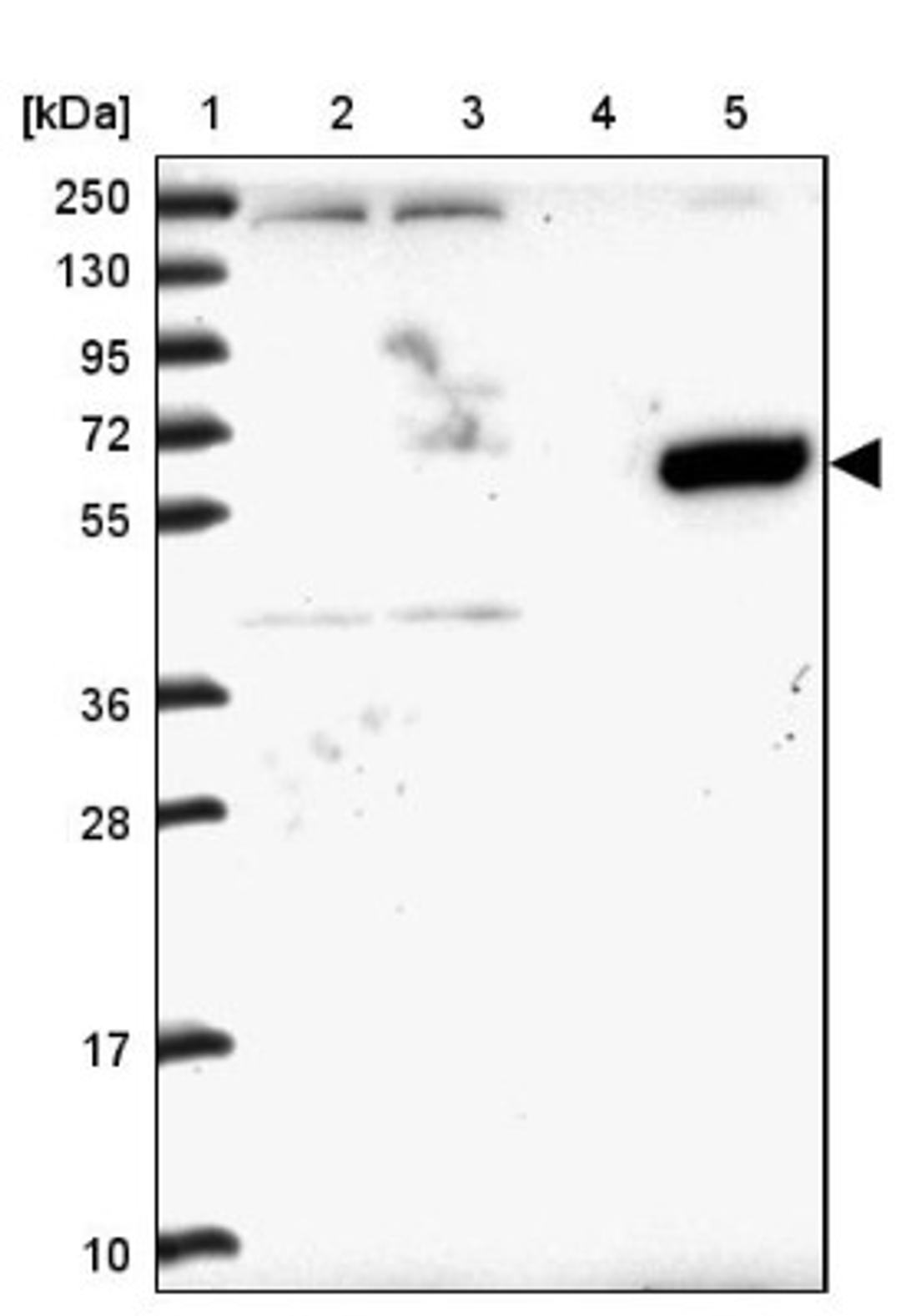 Immunohistochemistry: ZNF837 Antibody [NBP1-90888] - Lane 1: Marker [kDa] 250, 130, 95, 72, 55, 36, 28, 17, 10<br/>Lane 2: Human cell line RT-4<br/>Lane 3: Human cell line U-251MG sp<br/>Lane 4: Human plasma (IgG/HSA depleted)<br/>Lane 5: Human liver tissue