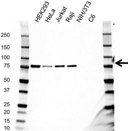 Western blot analysis of whole cell lysates probed with RIPK1 antibody 