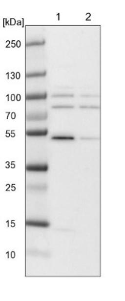 Western Blot: TTLL9 Antibody [NBP1-92543] - Lane 1: NIH-3T3 cell lysate (Mouse embryonic fibroblast cells)<br/>Lane 2: NBT-II cell lysate (Rat Wistar bladder tumour cells)