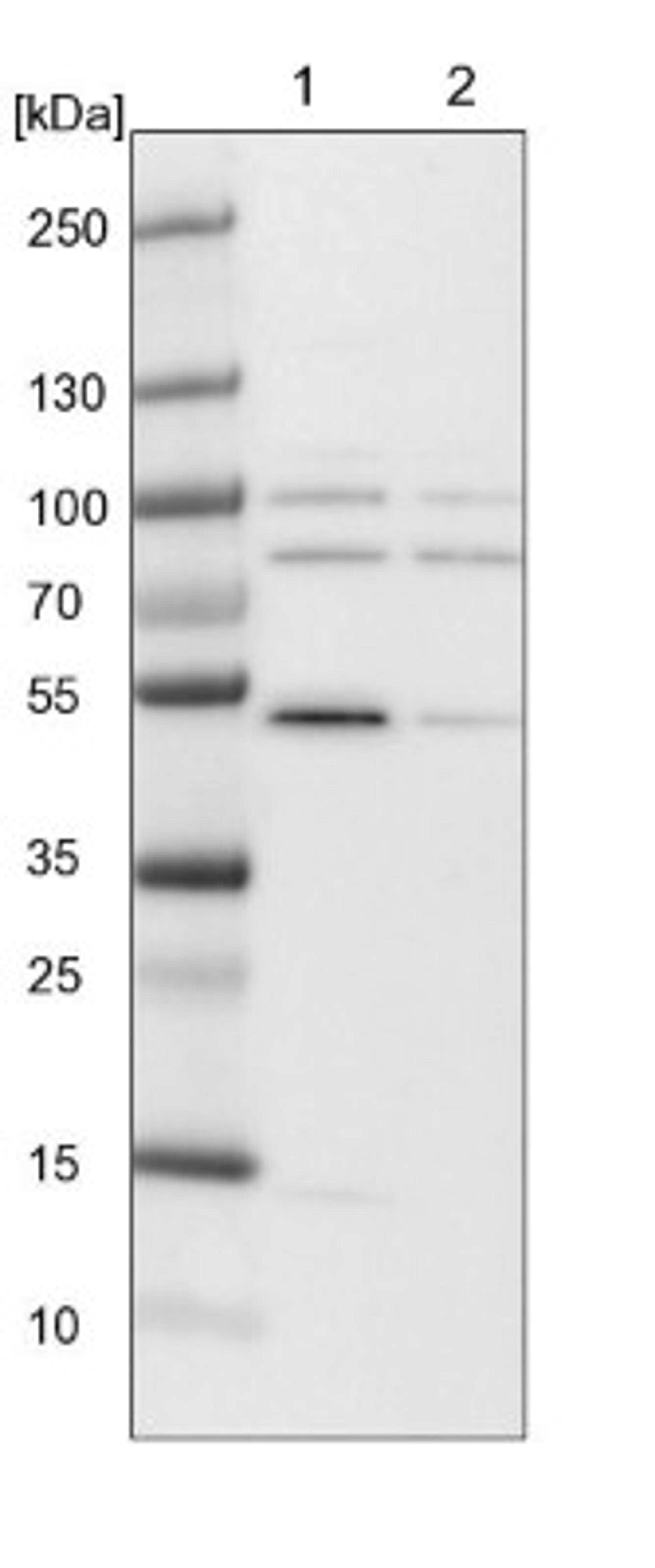 Western Blot: TTLL9 Antibody [NBP1-92543] - Lane 1: NIH-3T3 cell lysate (Mouse embryonic fibroblast cells)<br/>Lane 2: NBT-II cell lysate (Rat Wistar bladder tumour cells)