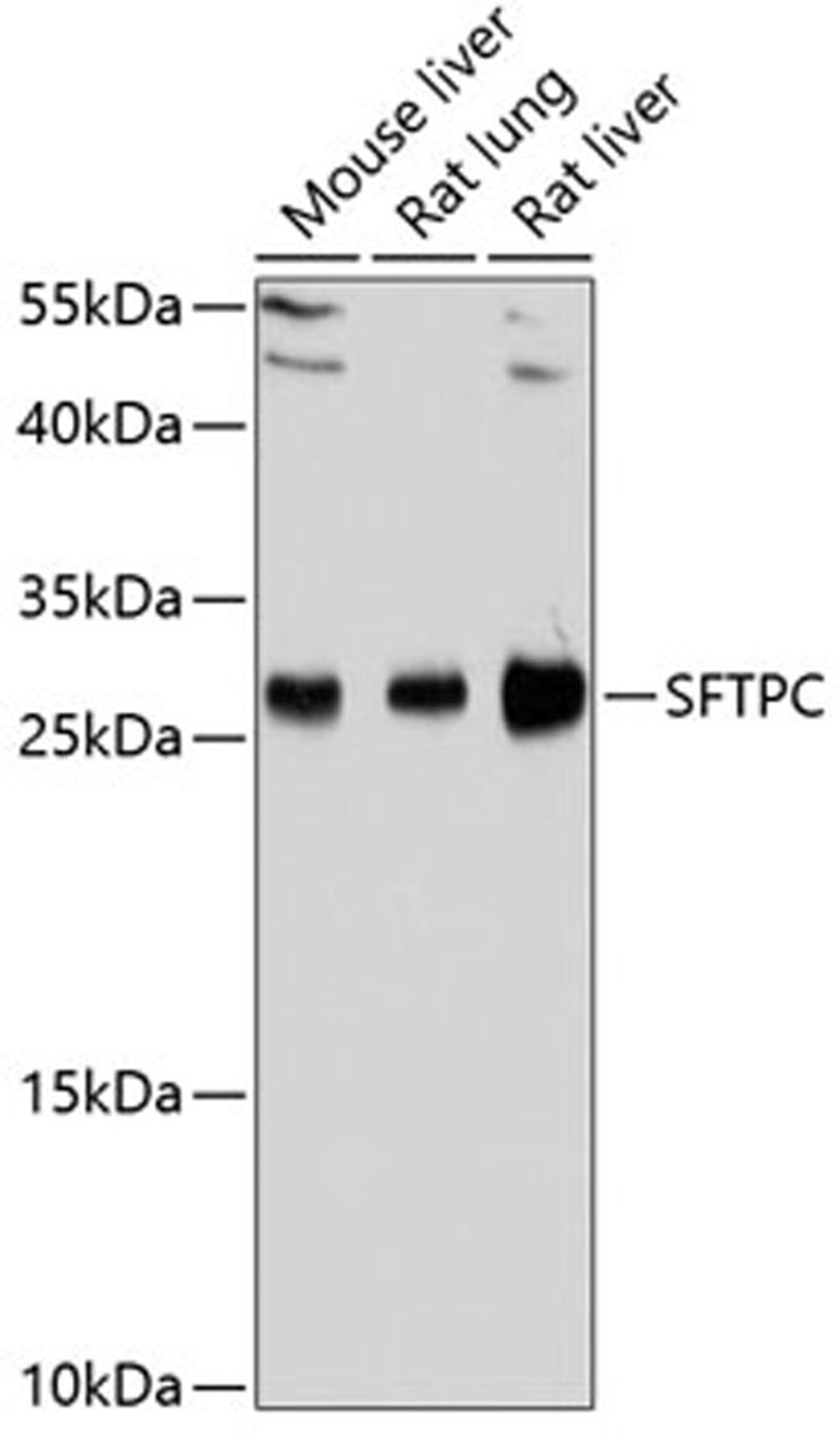 Western blot - SFTPC Antibody (A11764)