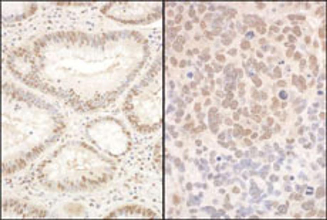 Detection of human and mouse PQBP1 by immunohistochemistry.