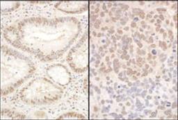 Detection of human and mouse PQBP1 by immunohistochemistry.