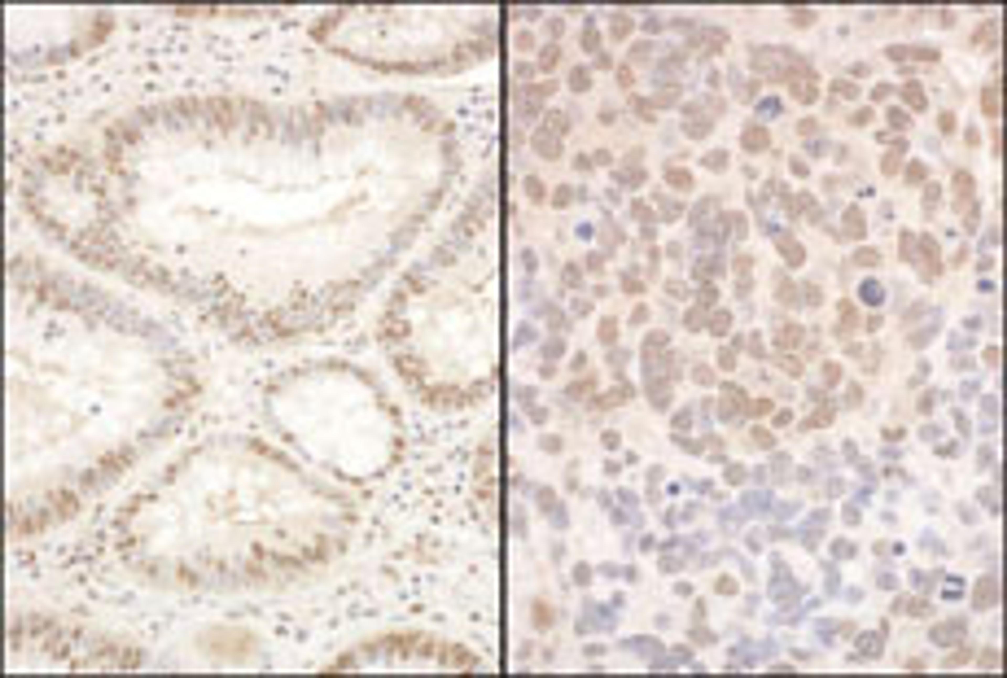 Detection of human and mouse PQBP1 by immunohistochemistry.