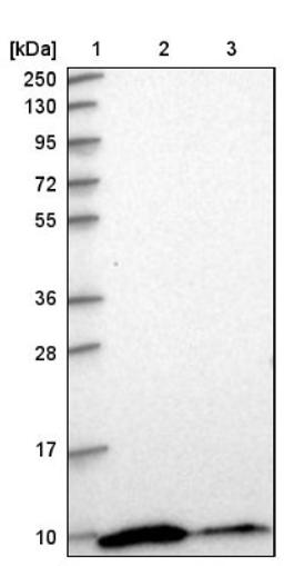 Western Blot: RPS28 Antibody [NBP1-92353] - Lane 1: Marker [kDa] 250, 130, 95, 72, 55, 36, 28, 17, 10<br/>Lane 2: Human cell line RT-4<br/>Lane 3: Human cell line U-251MG sp