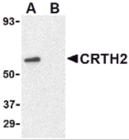 Western blot analysis of CRTH2 in Jurkat cell lysate with CRTH2 antibody at 1 &#956;g/mL in (A) the absence and (B) presence of blocking peptide.