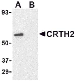 Western blot analysis of CRTH2 in Jurkat cell lysate with CRTH2 antibody at 1 μg/mL in (A) the absence and (B) presence of blocking peptide.
