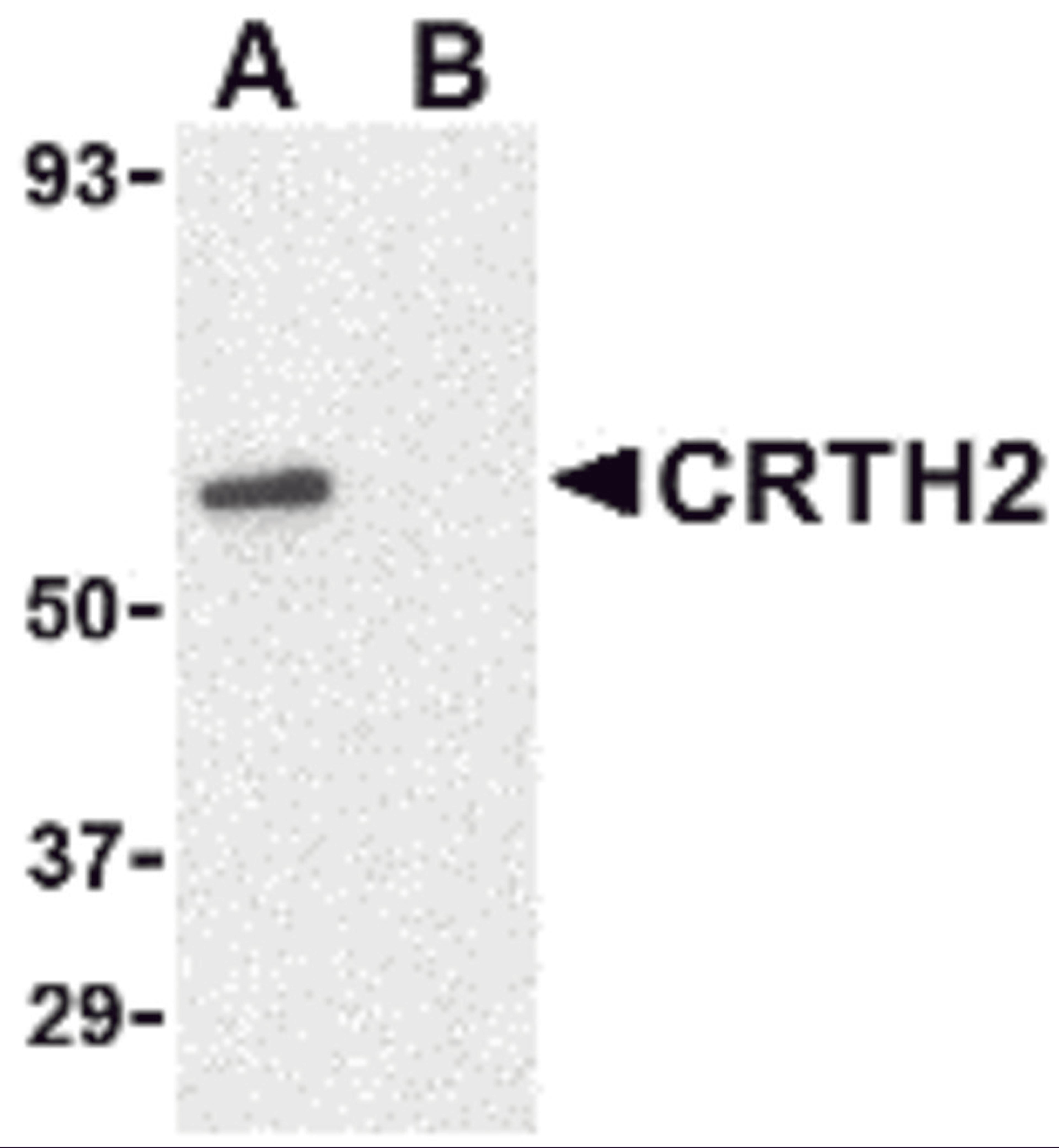 Western blot analysis of CRTH2 in Jurkat cell lysate with CRTH2 antibody at 1 μg/mL in (A) the absence and (B) presence of blocking peptide.