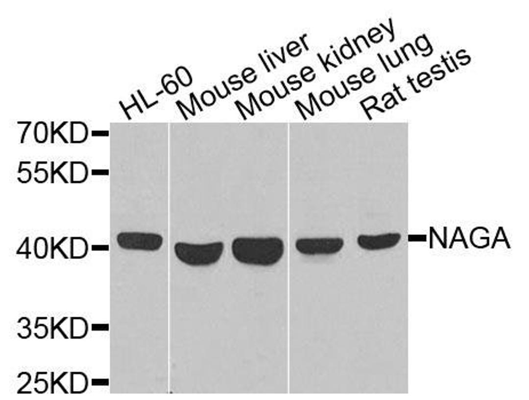 Western blot analysis of extracts of various cells using NAGA antibody