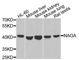 Western blot analysis of extracts of various cells using NAGA antibody