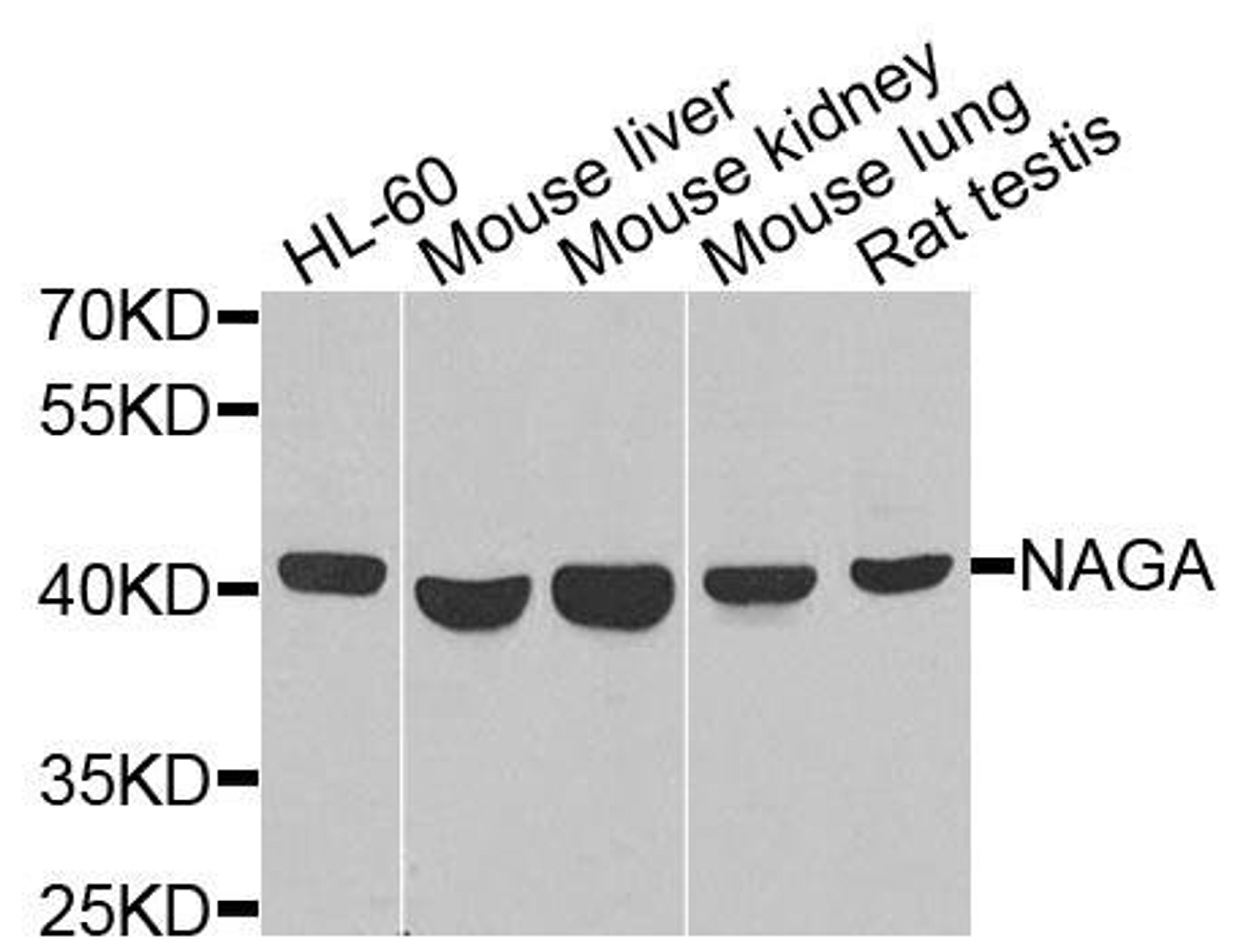 Western blot analysis of extracts of various cells using NAGA antibody