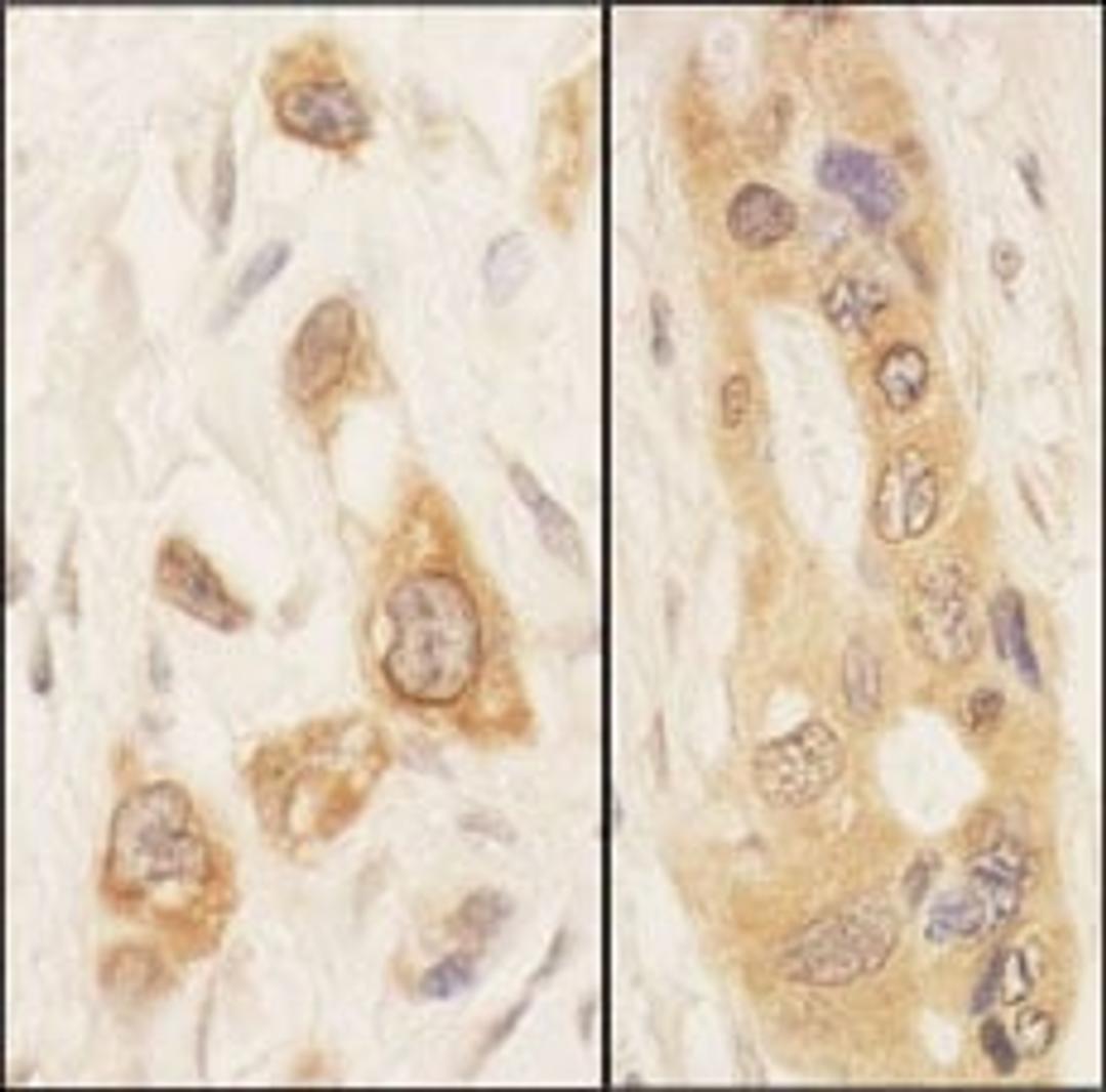 Detection of human SPAK by immunohistochemistry.