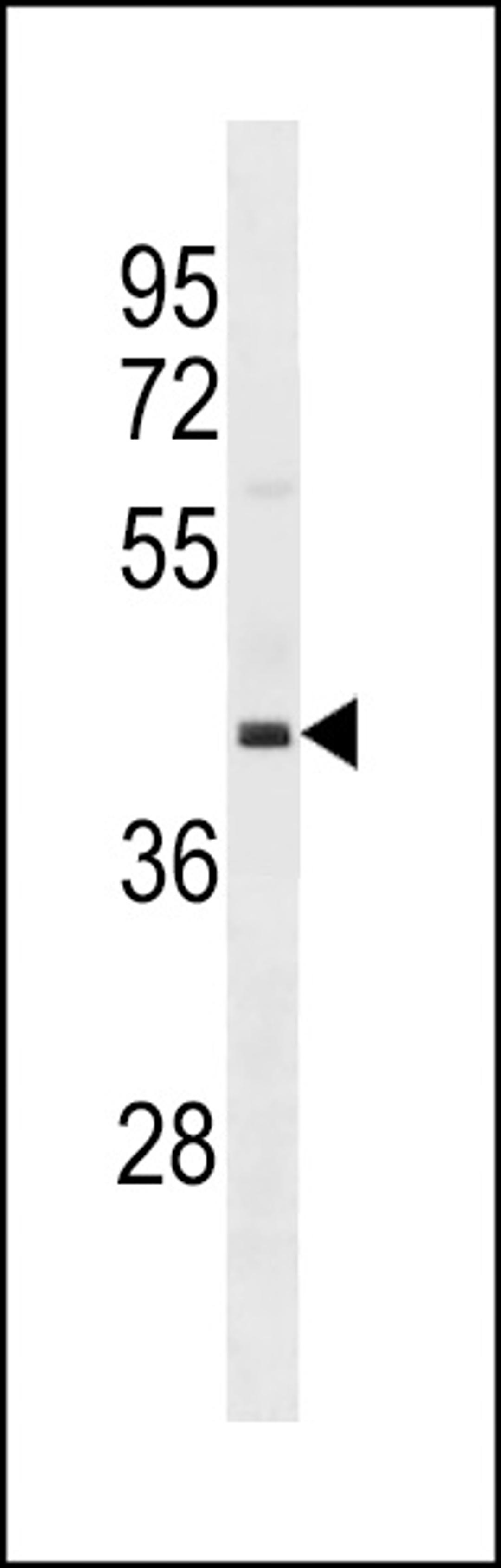 Western blot analysis in 293 cell line lysates (35ug/lane).