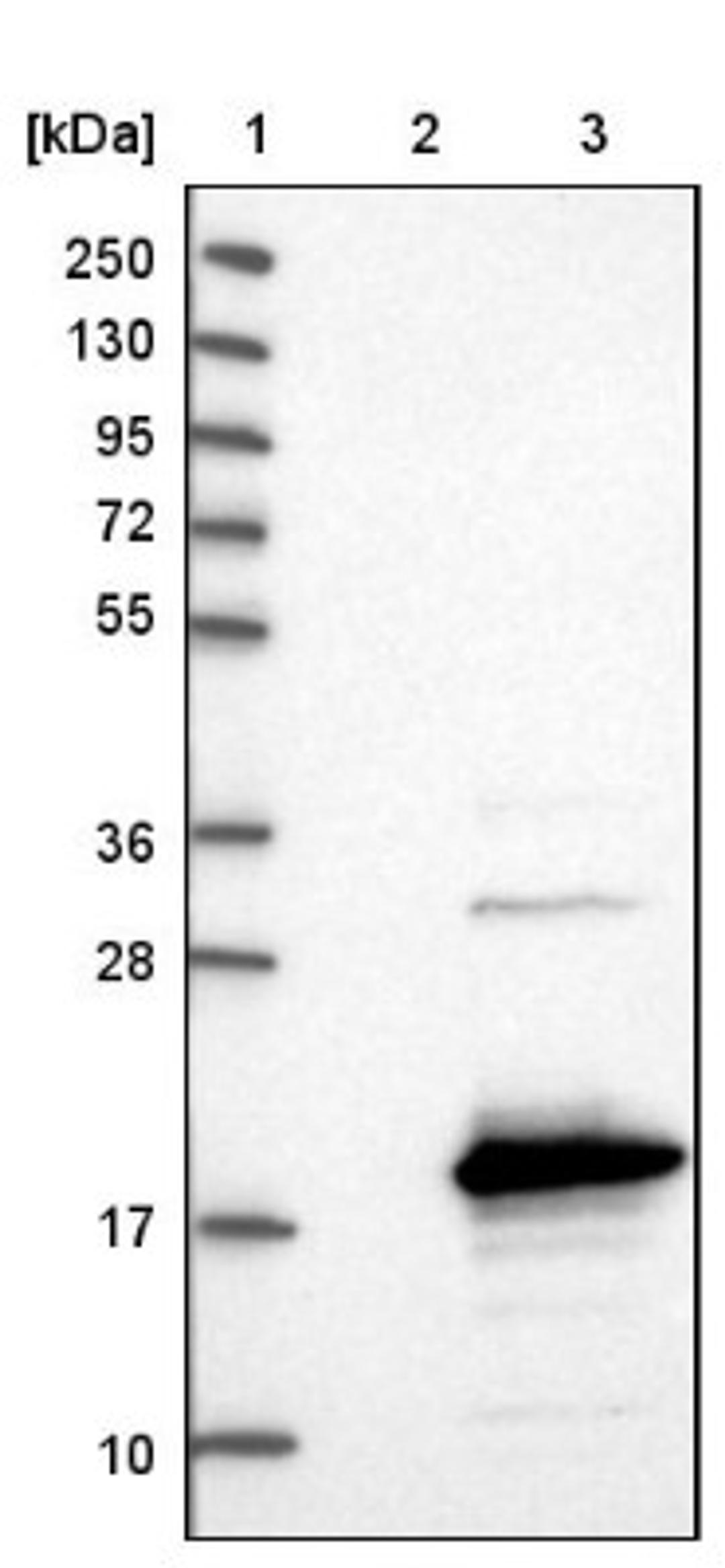 Western Blot: SAMD12 Antibody [NBP1-81927] - Lane 1: Marker [kDa] 250, 130, 95, 72, 55, 36, 28, 17, 10<br/>Lane 2: Negative control (vector only transfected HEK293T lysate)<br/>Lane 3: Over-expression lysate (Co-expressed with a C-terminal myc-DDK tag (~3.1 kDa) in mammalian HEK293T cells, LY404050)